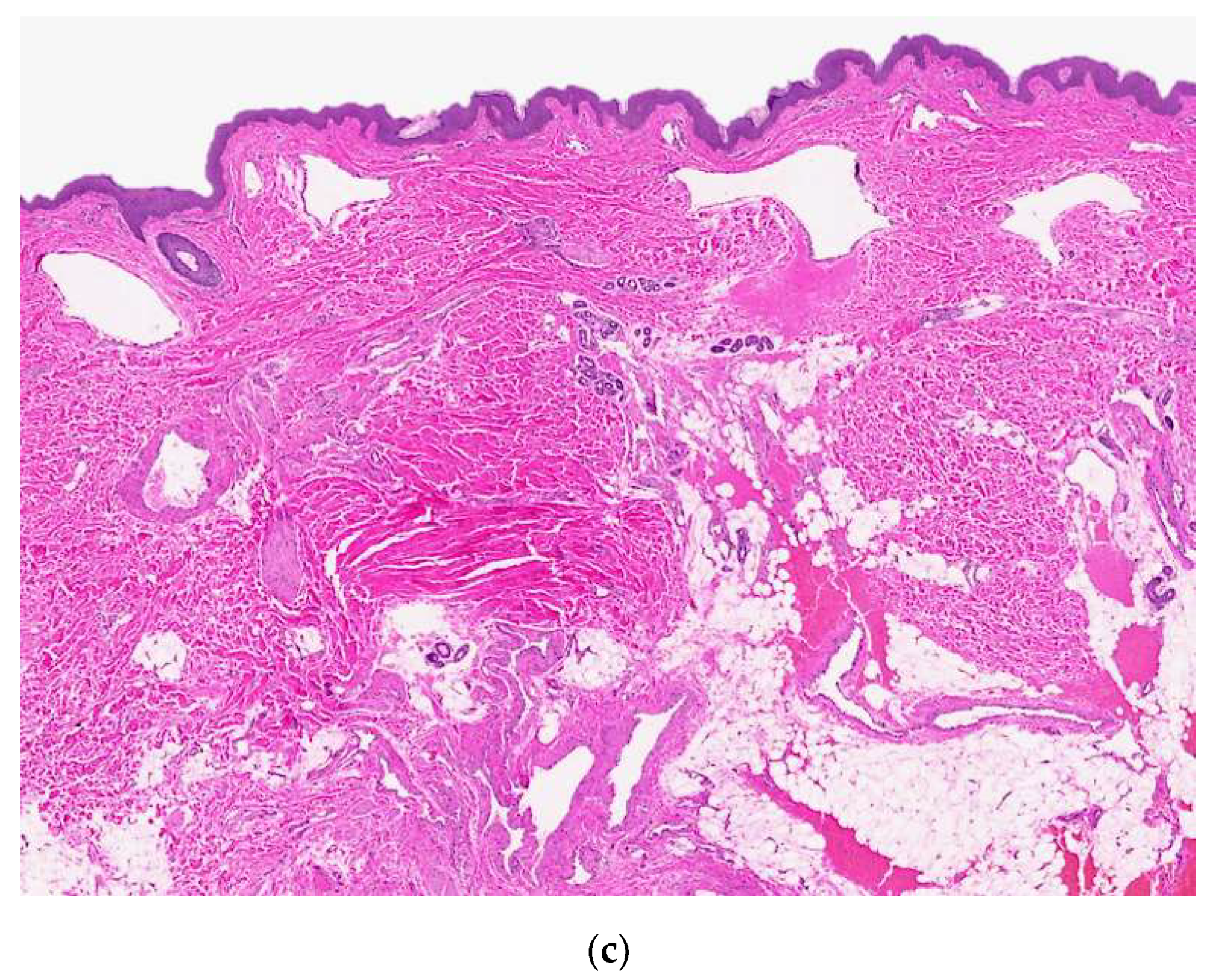 Dermatopathology 08 00050 g004b 550