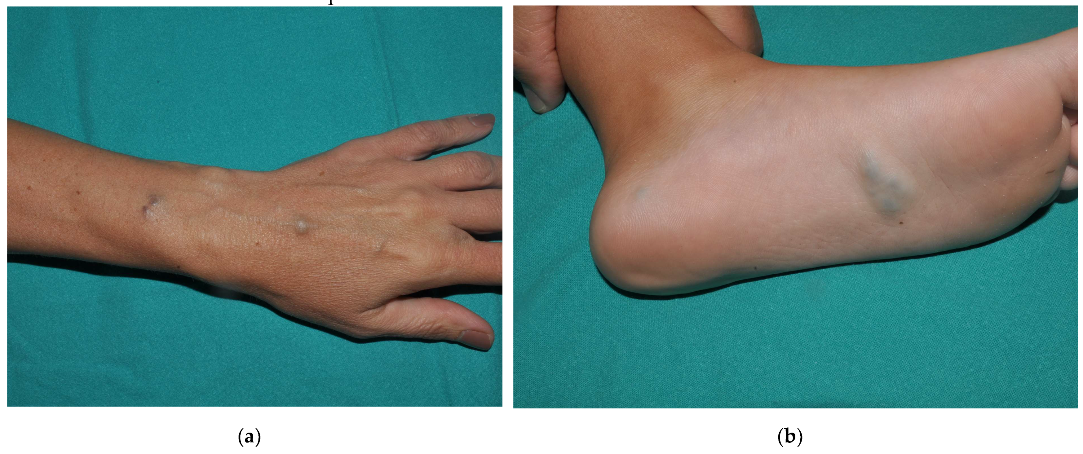 Dermatopathology 08 00050 g005a 550