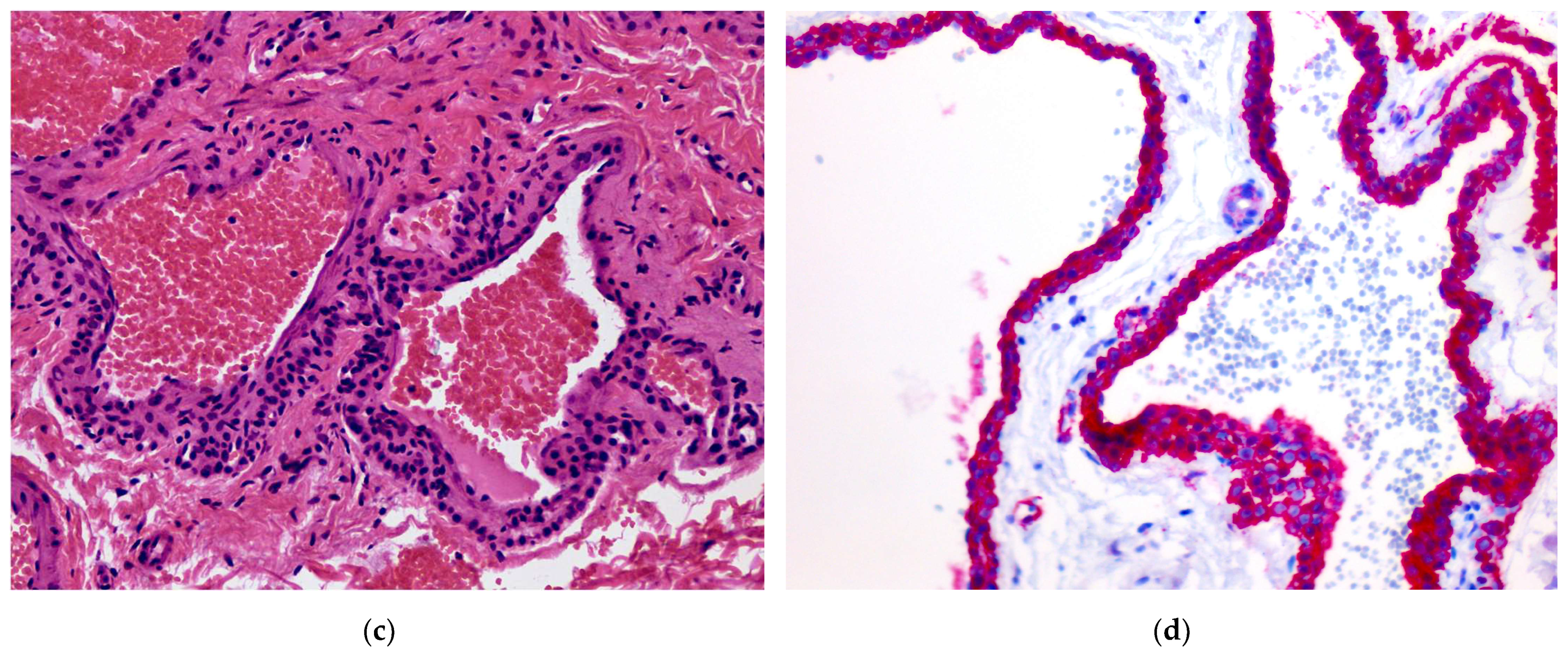 Dermatopathology 08 00050 g005b 550