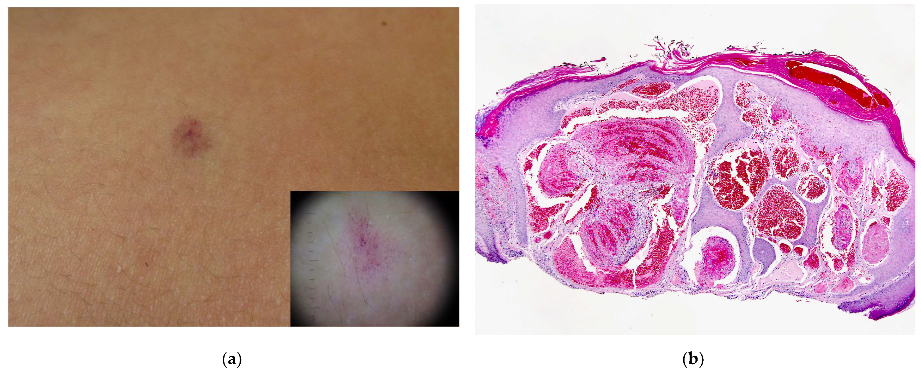 Dermatopathology 08 00050 g006 550