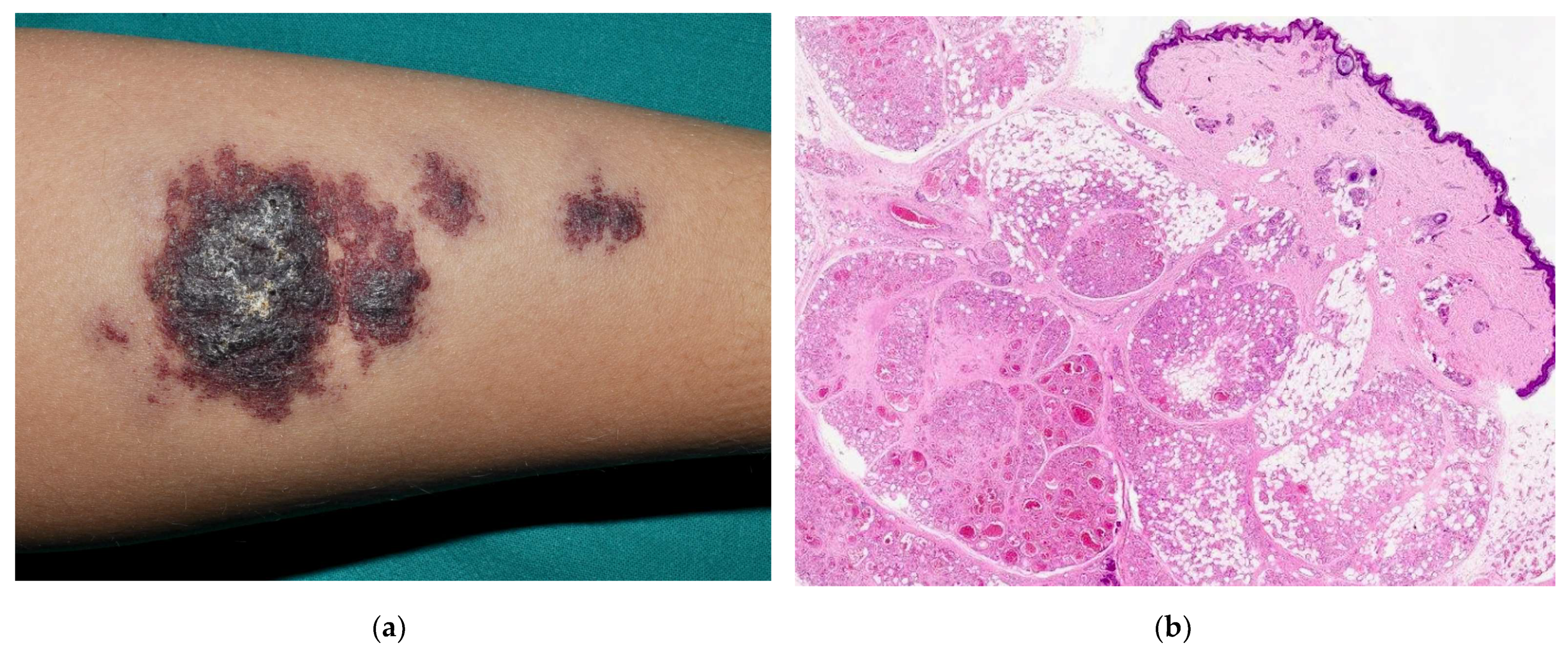 Dermatopathology 08 00050 g007a 550