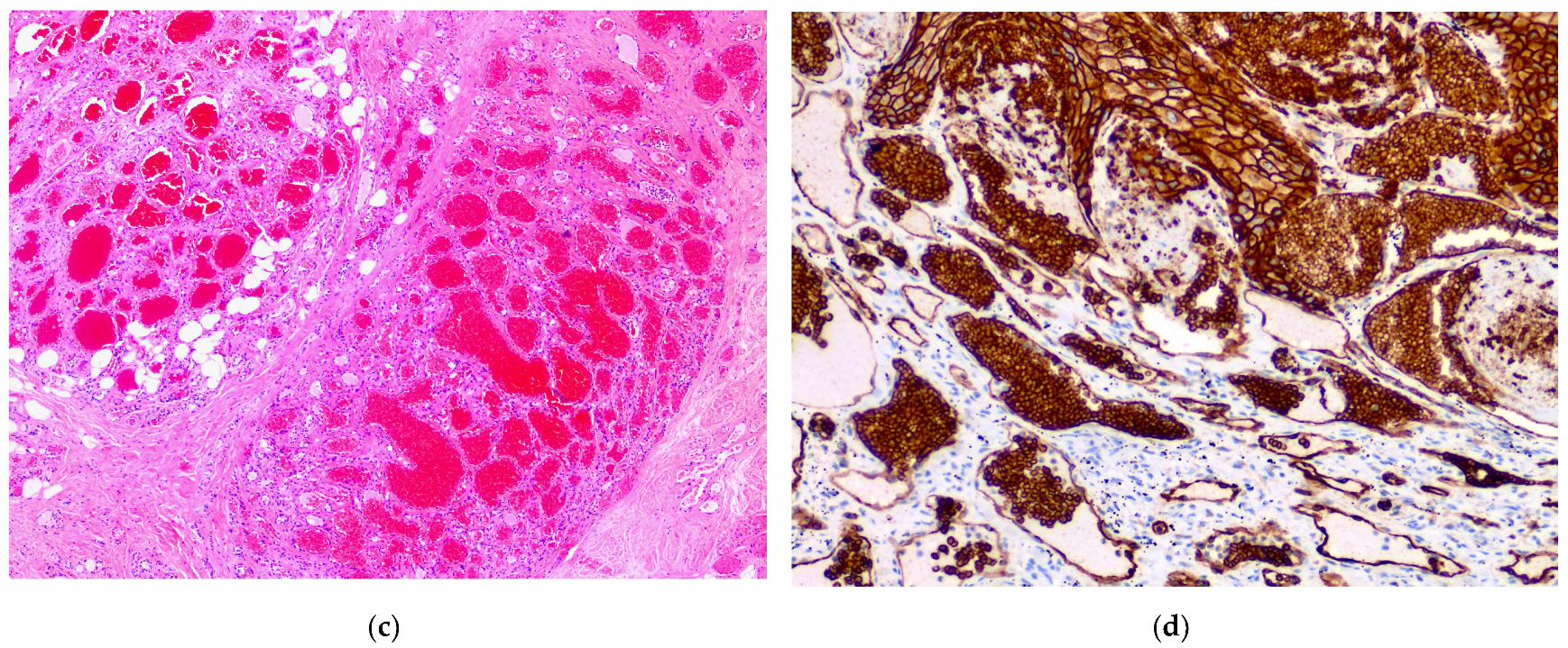 Dermatopathology 08 00050 g007b 550