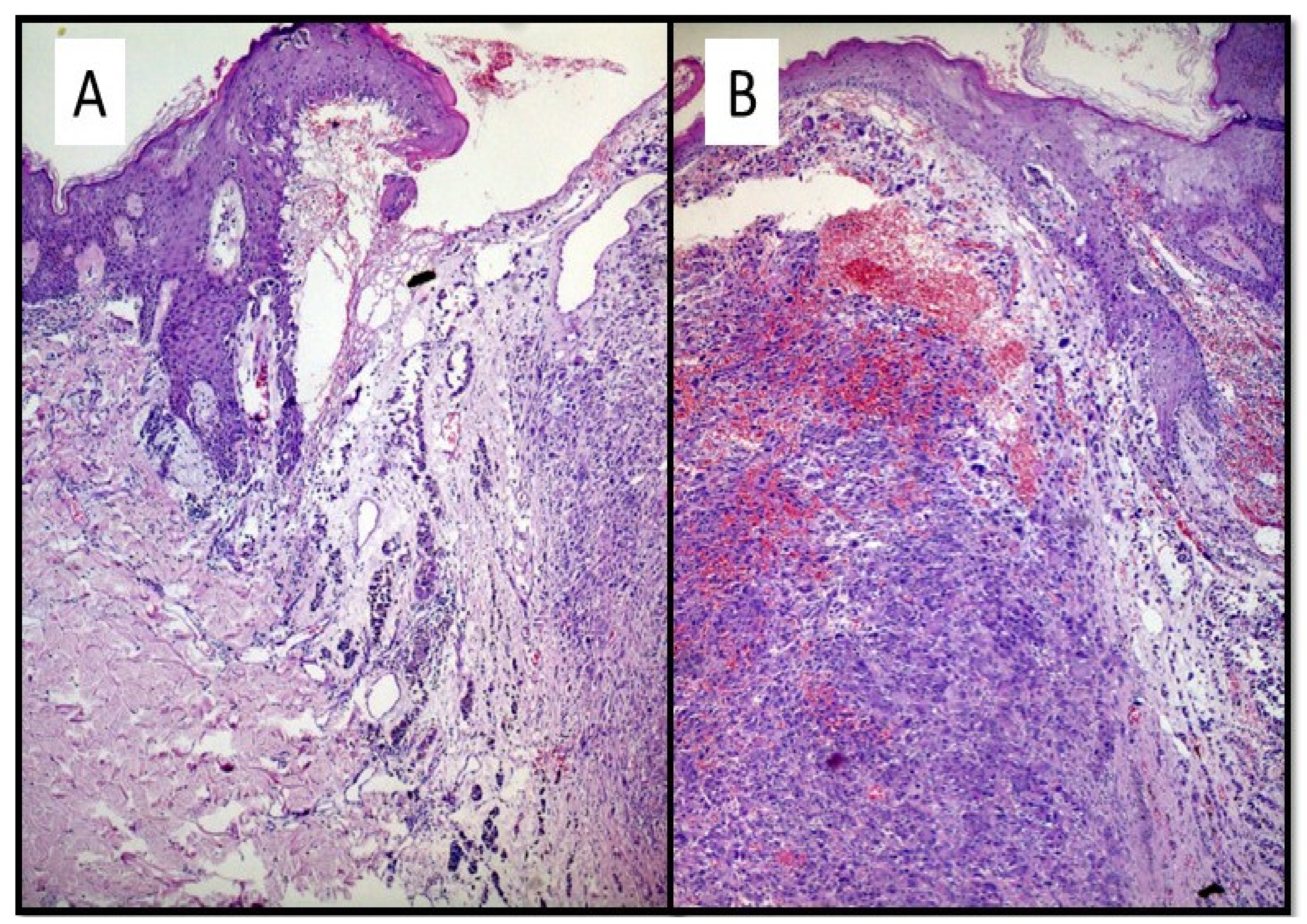 Dermatopathology 08 00051 g002a