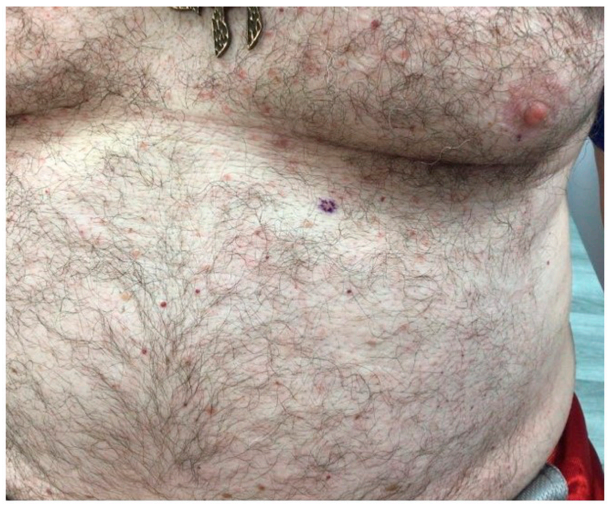 Dermatopathology 08 00052 g001