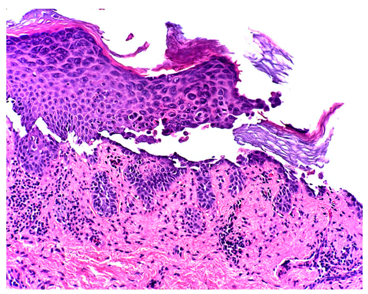 Dermatopathology 08 00052 g003