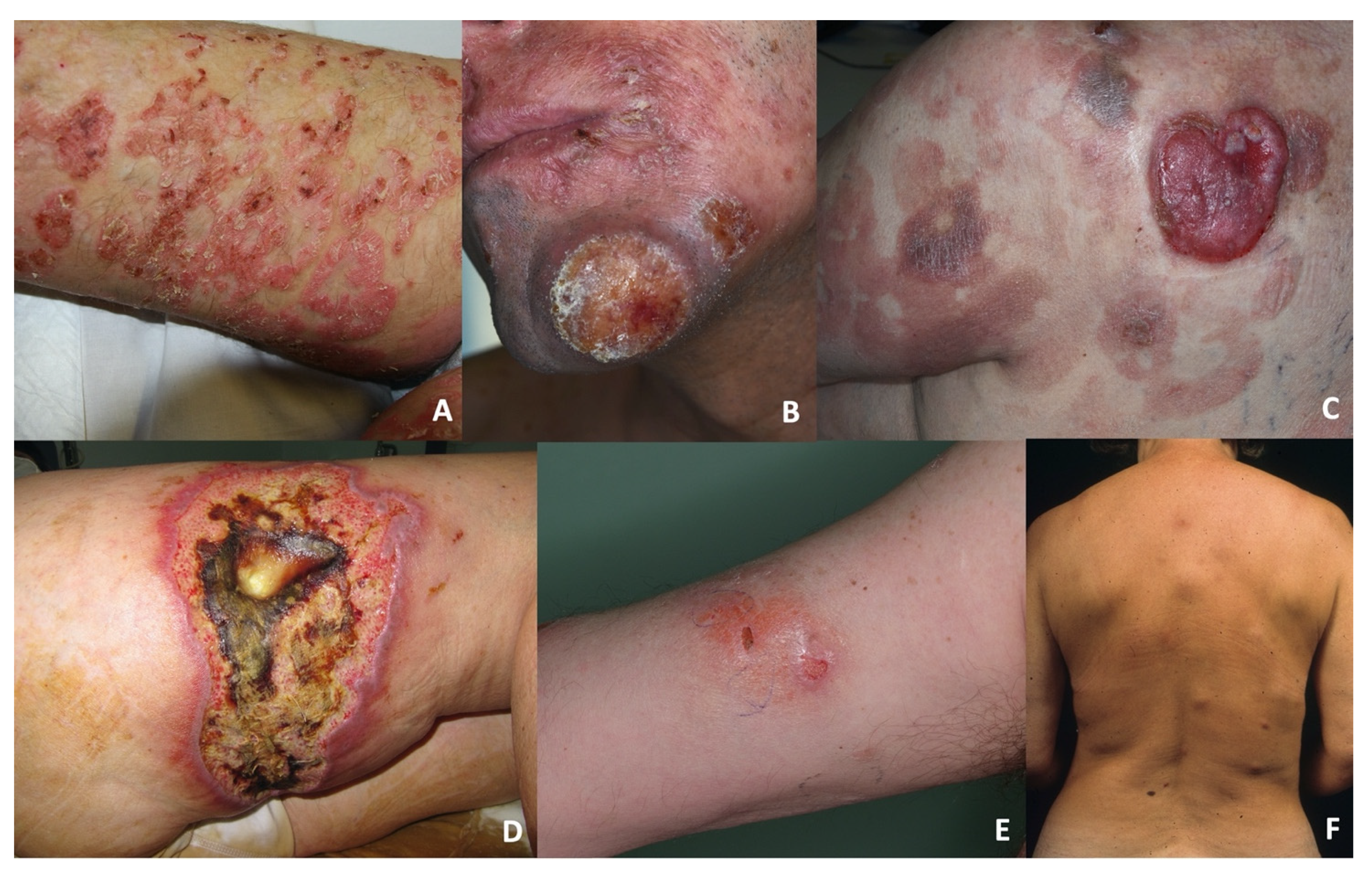 Dermatopathology 08 00054 g001 550