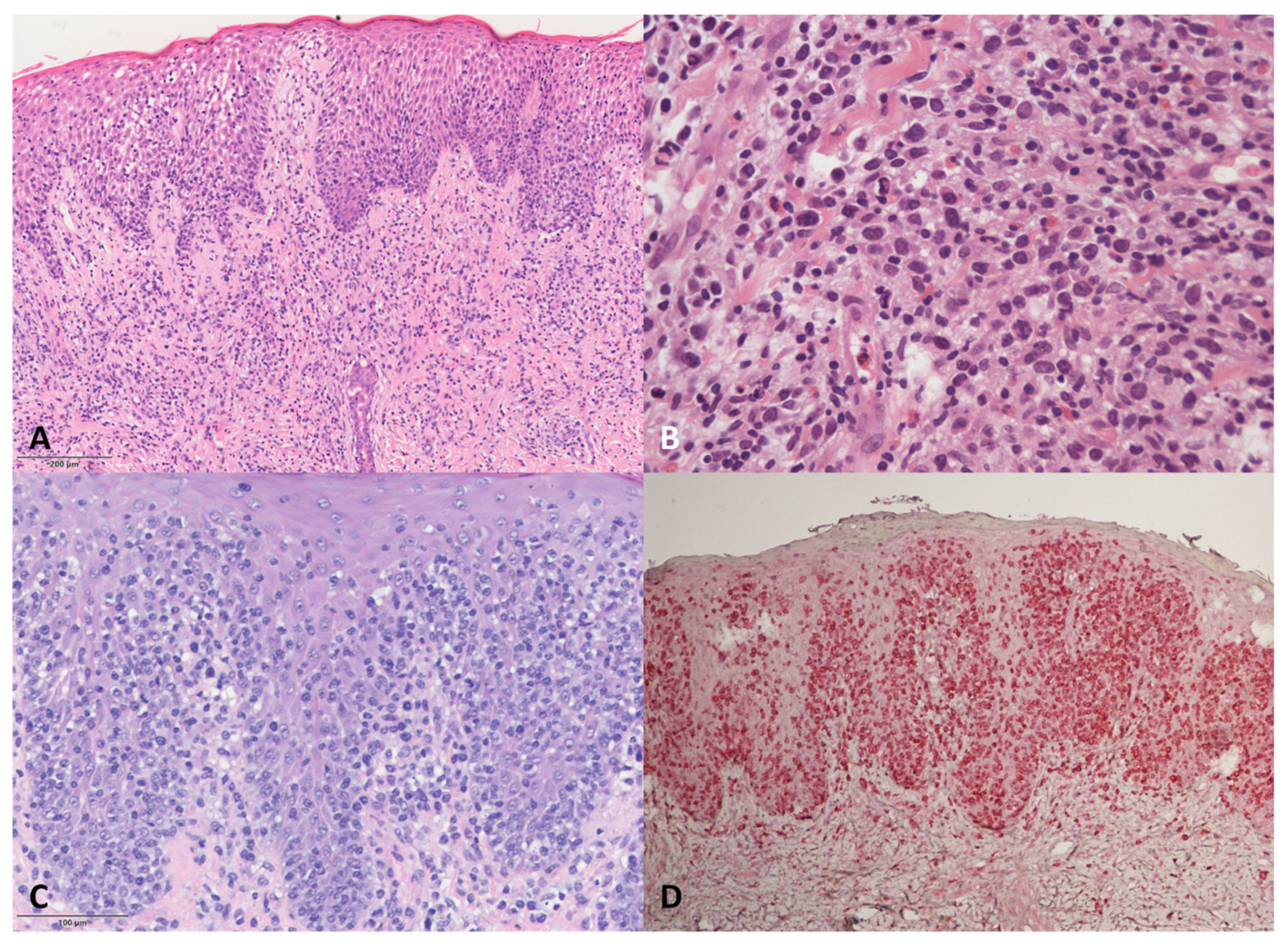 Dermatopathology 08 00054 g002 550