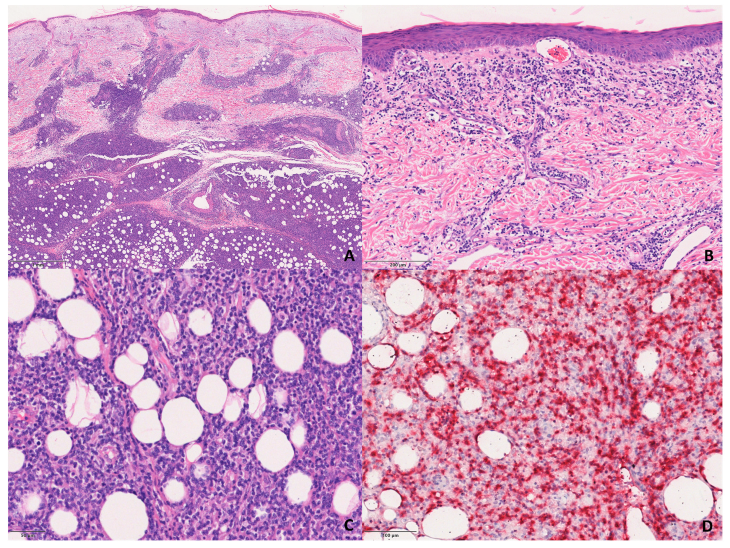 Dermatopathology 08 00054 g003 550