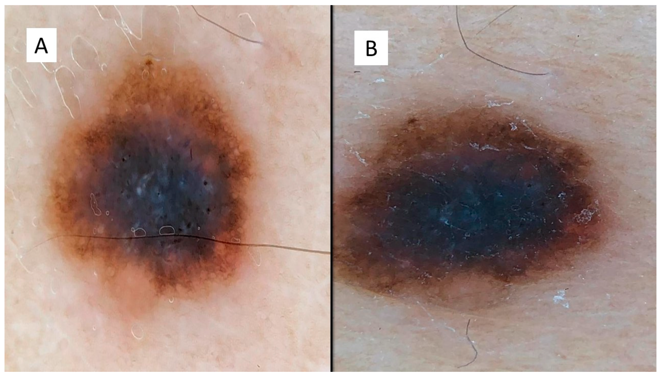 Dermatopathology 08 00055 g001 550