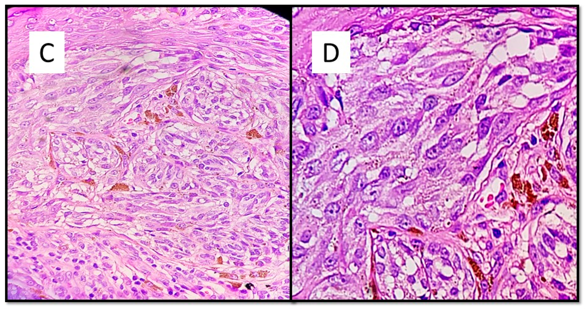 Dermatopathology 08 00055 g002b 550