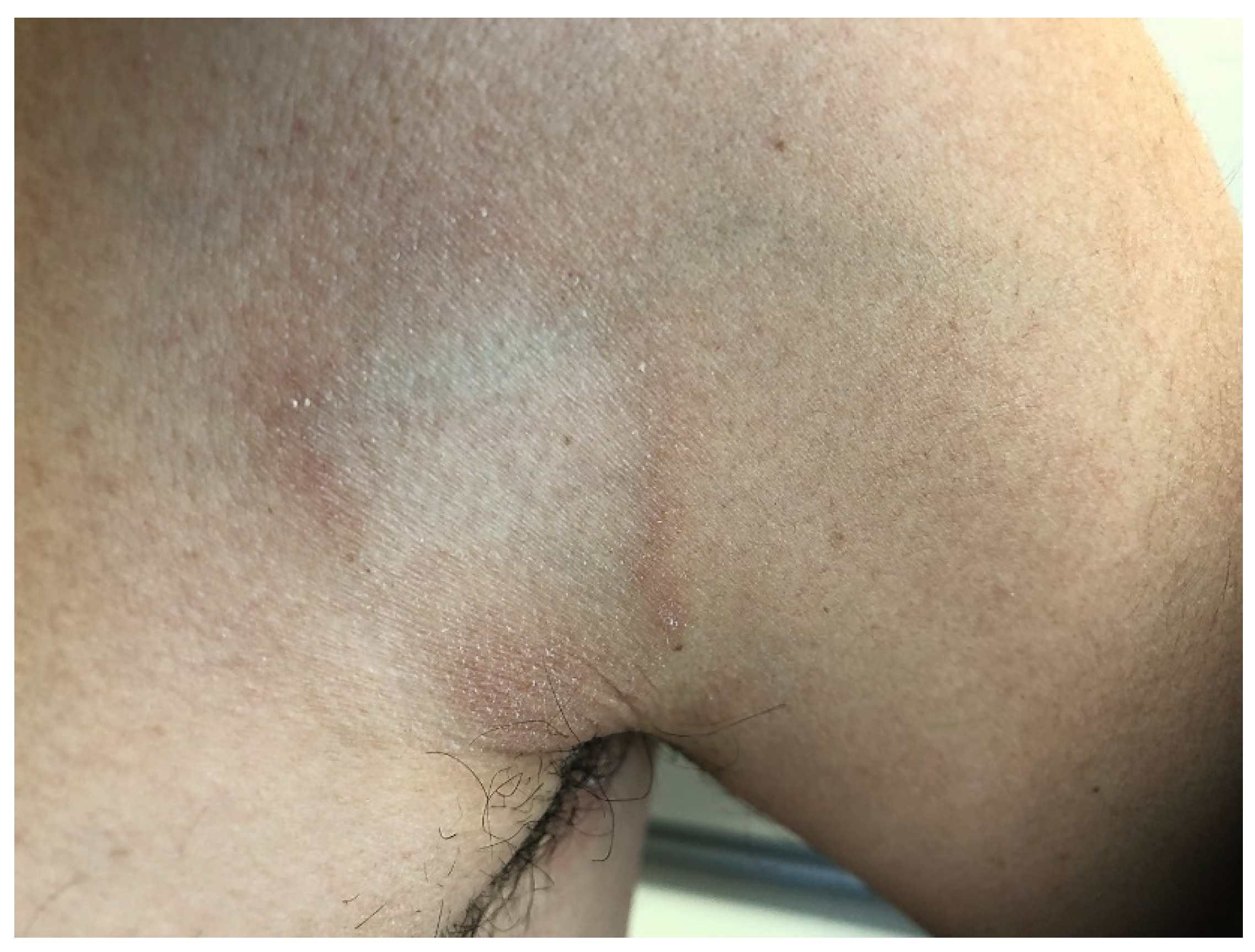 Dermatopathology 09 00004 g003