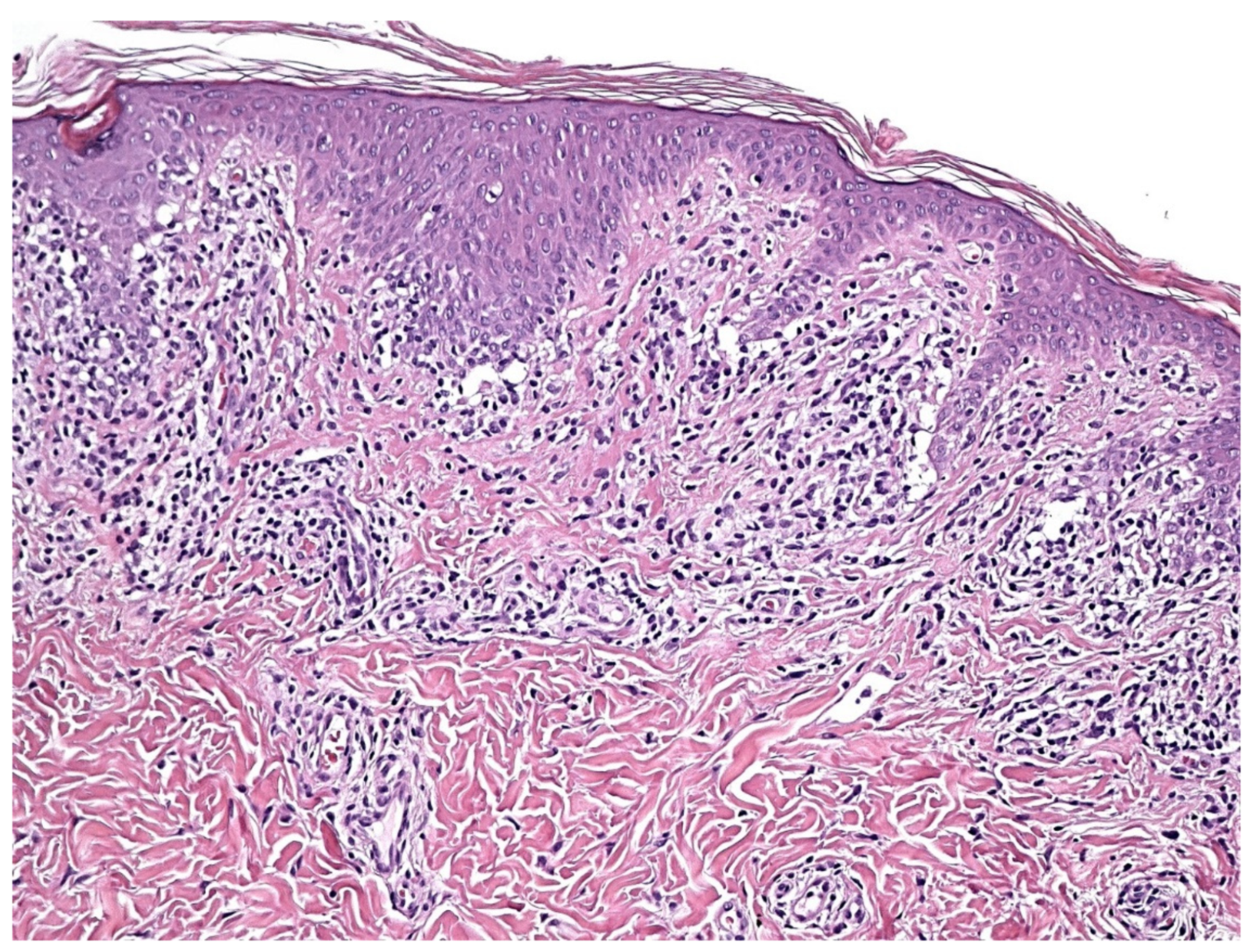 Dermatopathology 09 00004 g004