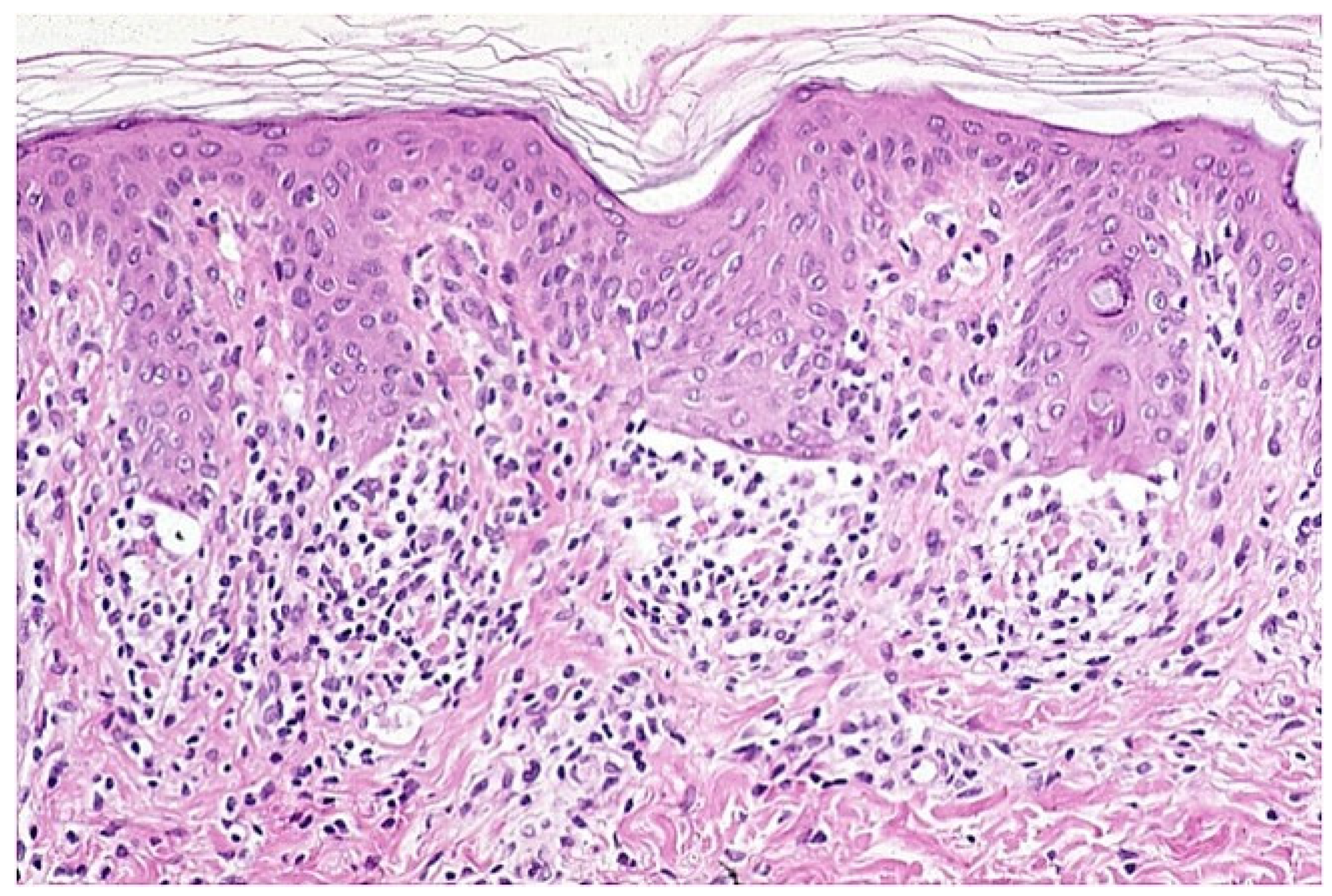 Dermatopathology 09 00004 g005
