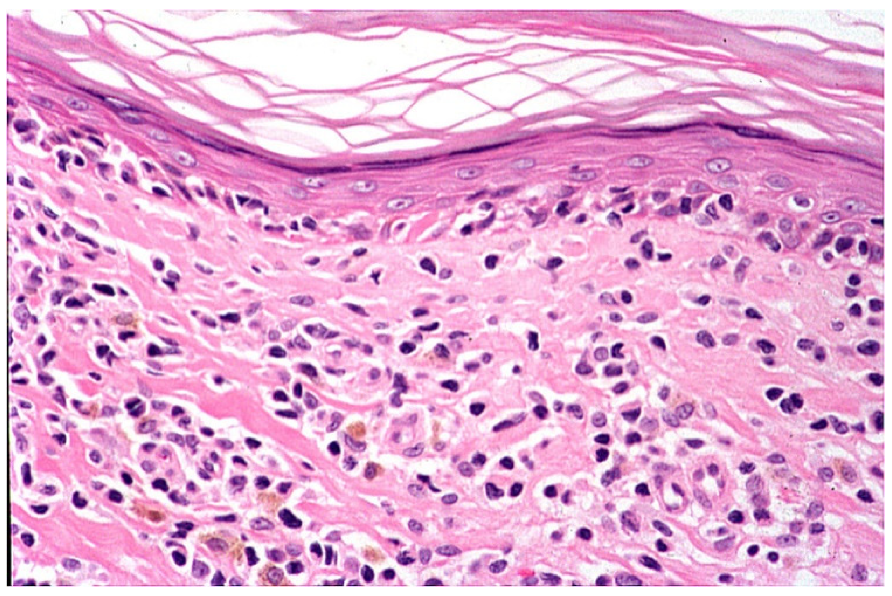 Dermatopathology 09 00004 g007