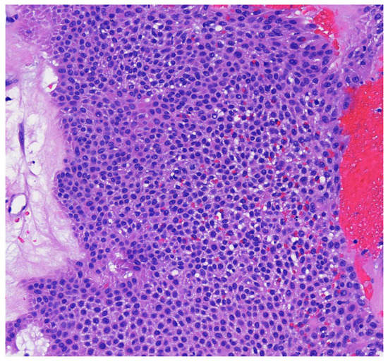 Dermatopathology 09 00007 g004 550