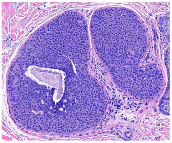 Dermatopathology 09 00007 g005 550