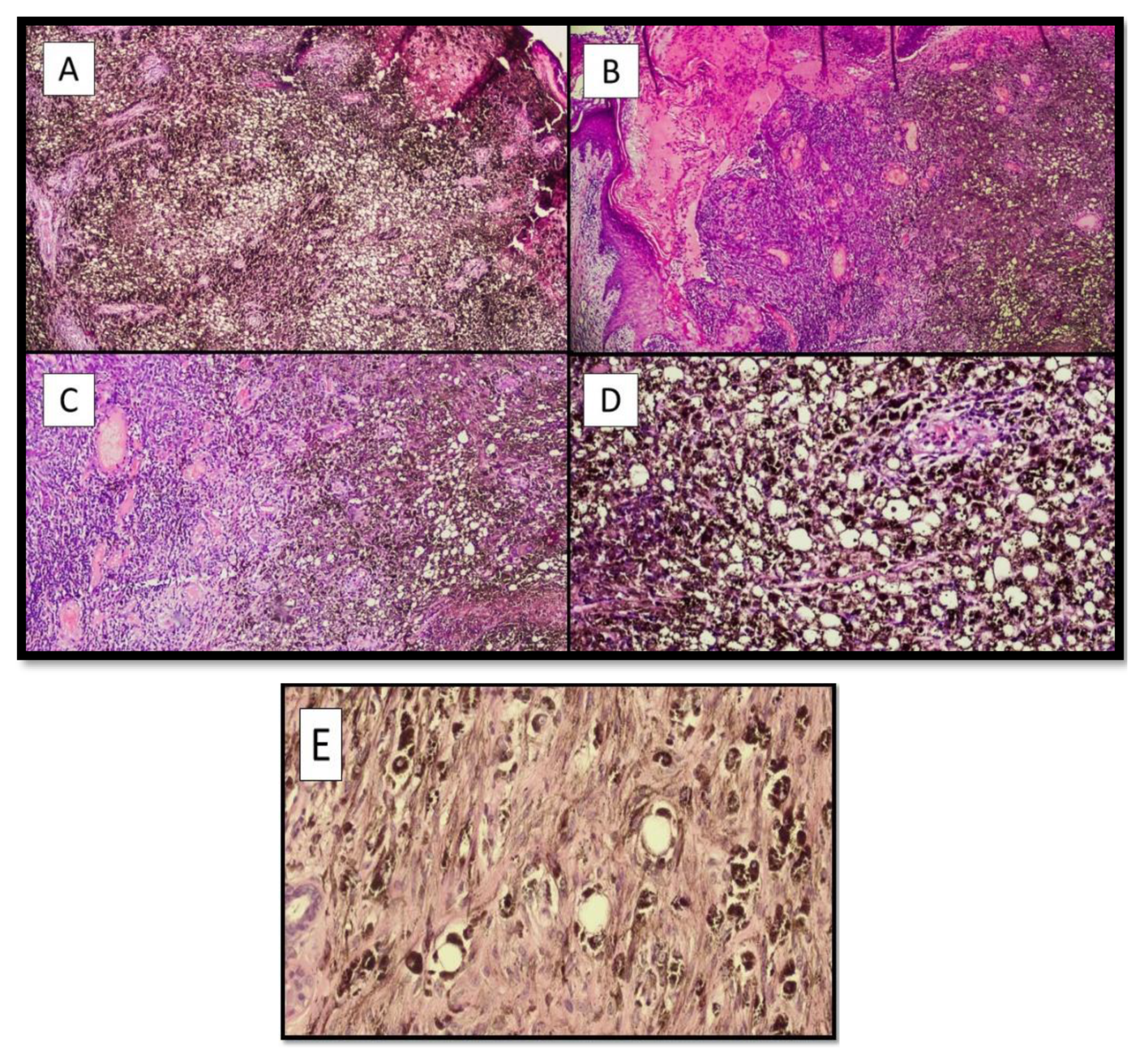 Dermatopathology 09 00013 g001