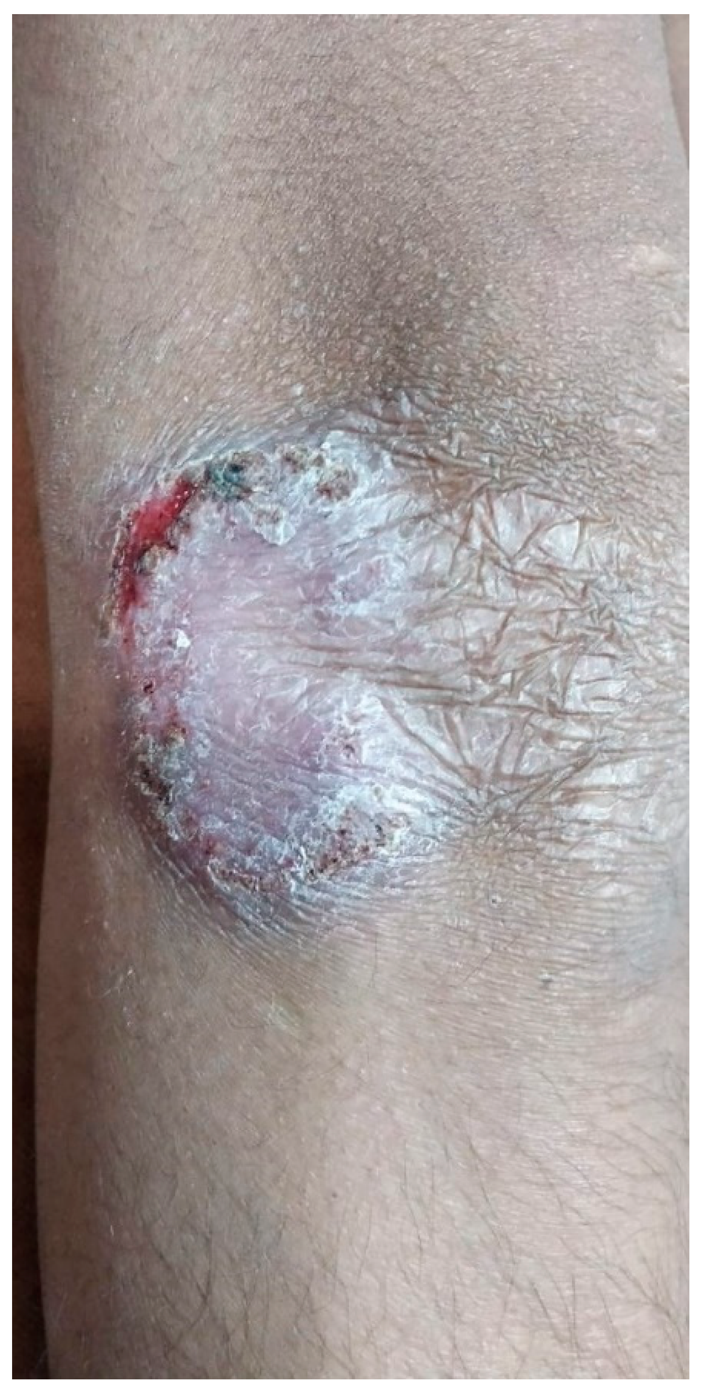 Dermatopathology 09 00016 g001 550