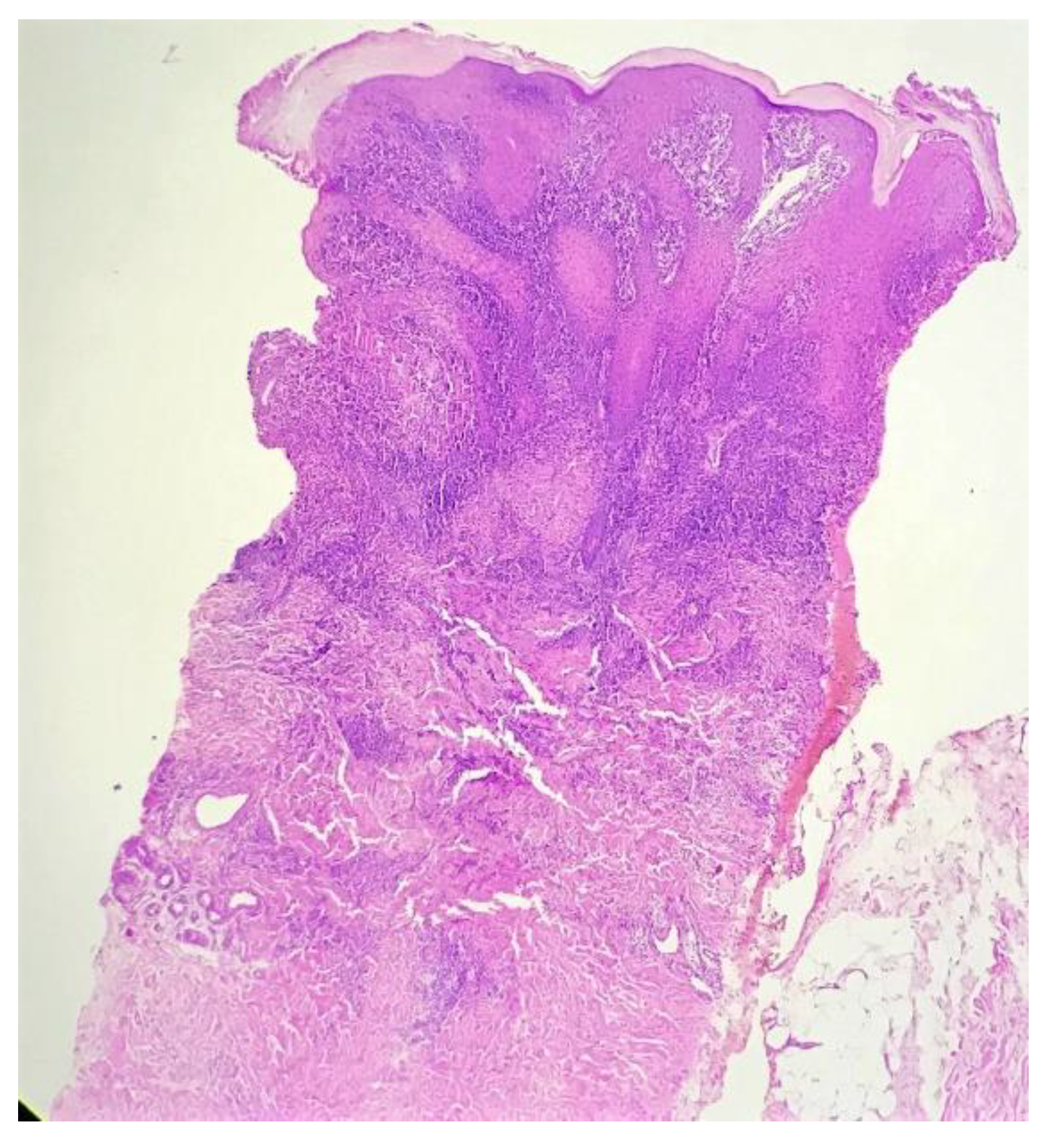 Dermatopathology 09 00016 g002 550