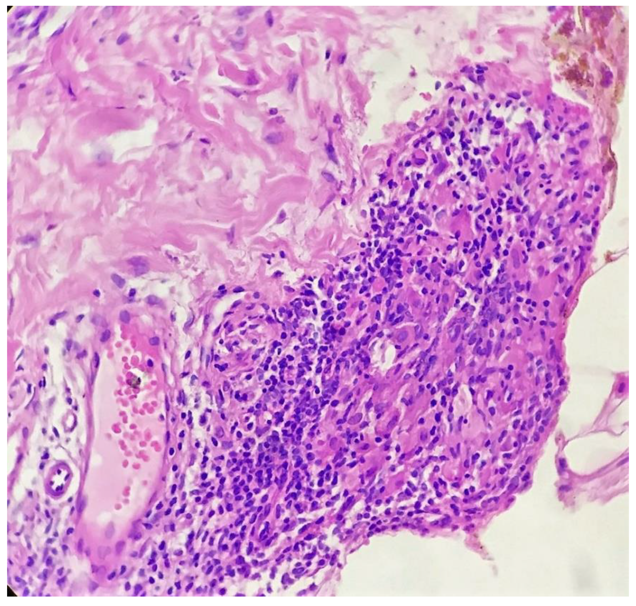 Dermatopathology 09 00016 g005 550