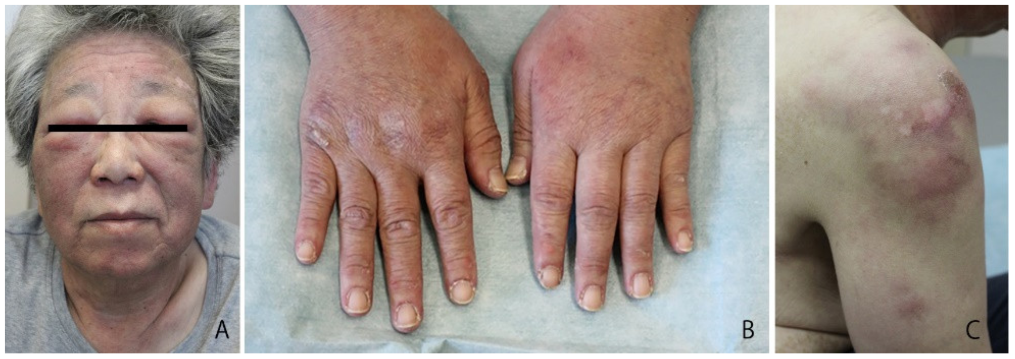 Dermatopathology 09 00018 g001 550