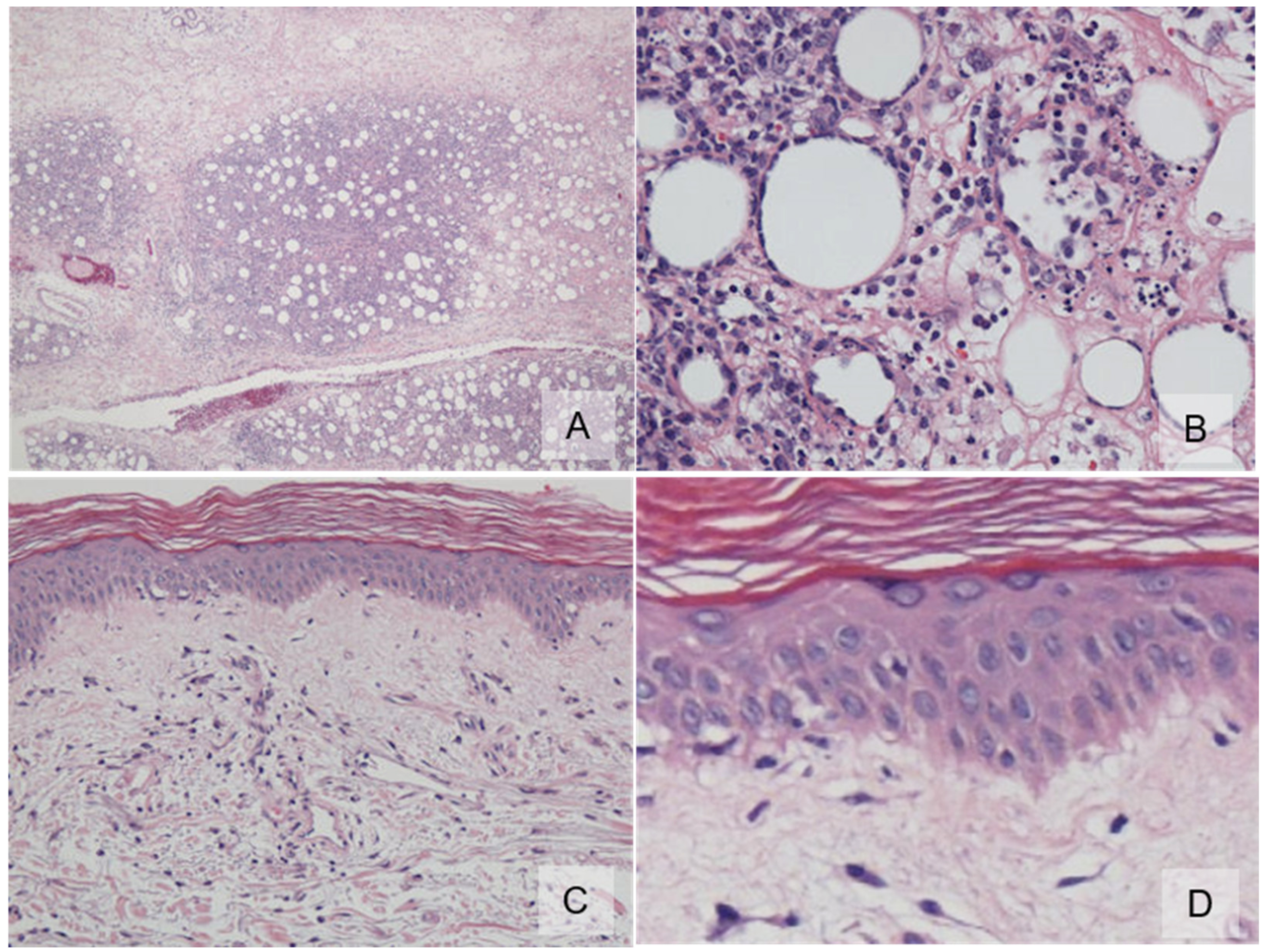 Dermatopathology 09 00018 g002 550