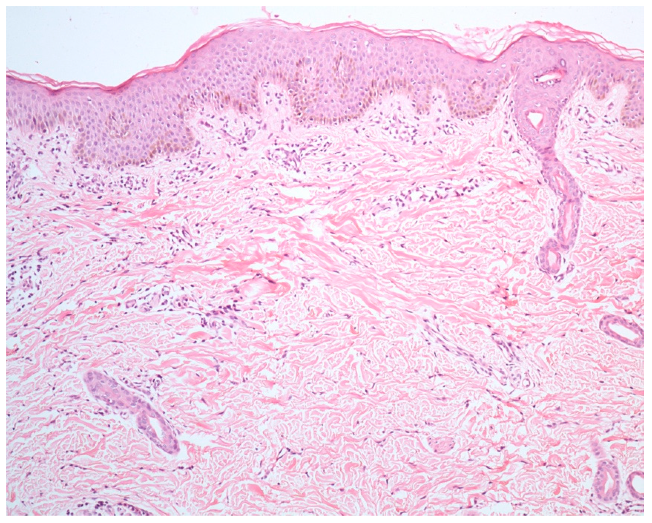 Dermatopathology 09 00021 g004 550