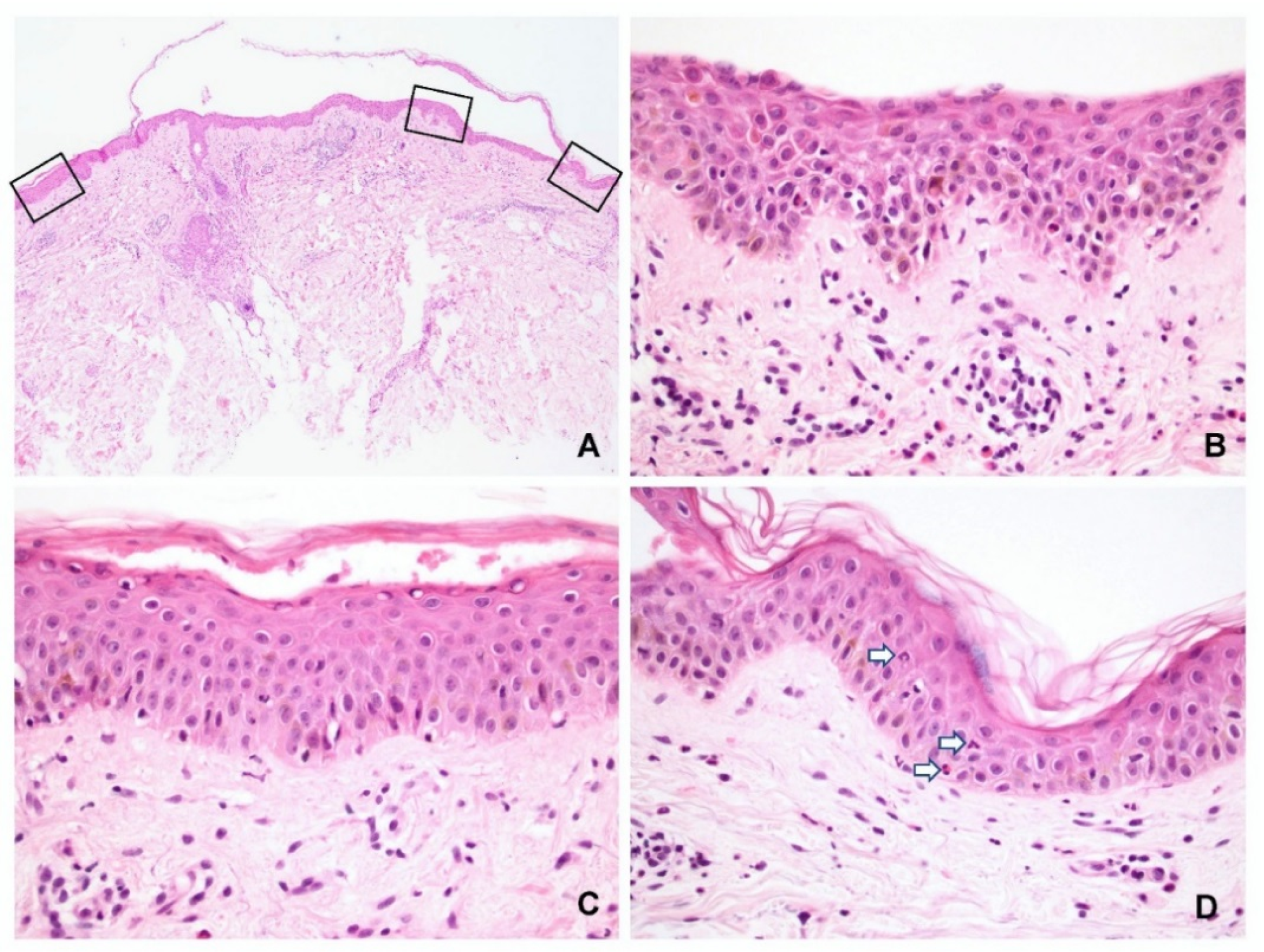 Dermatopathology 09 00022 g002 550