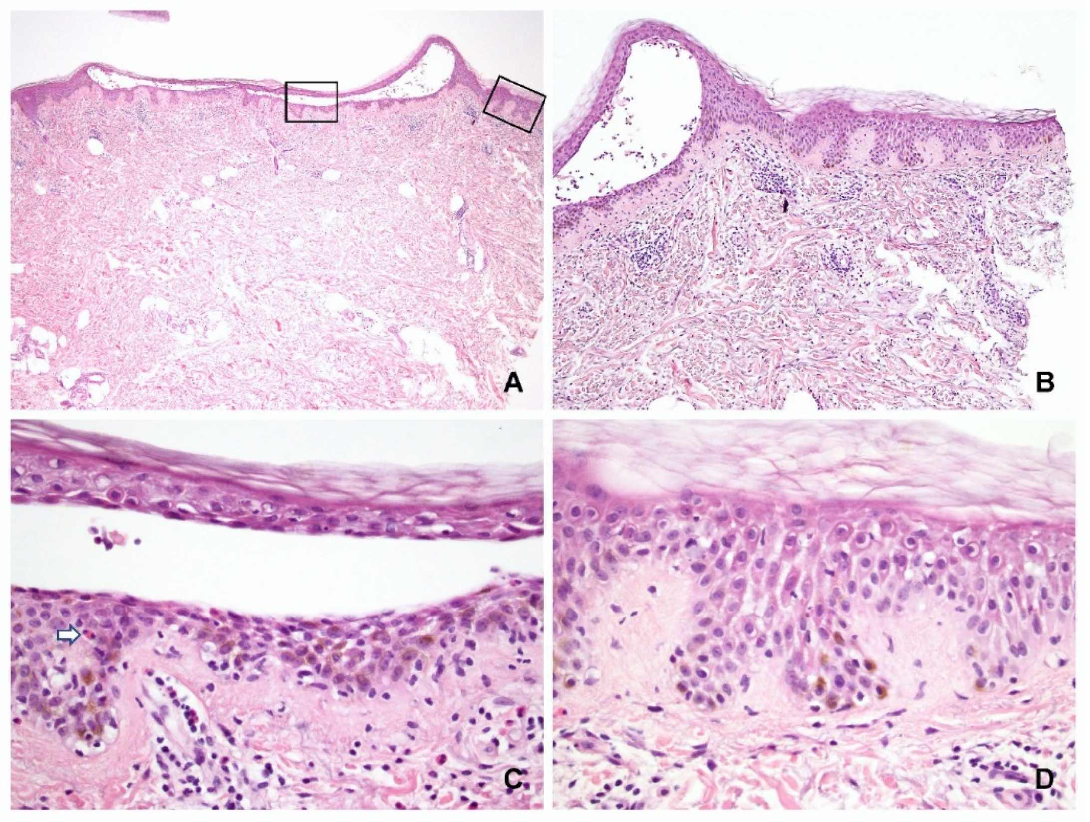 Dermatopathology 09 00022 g003 550
