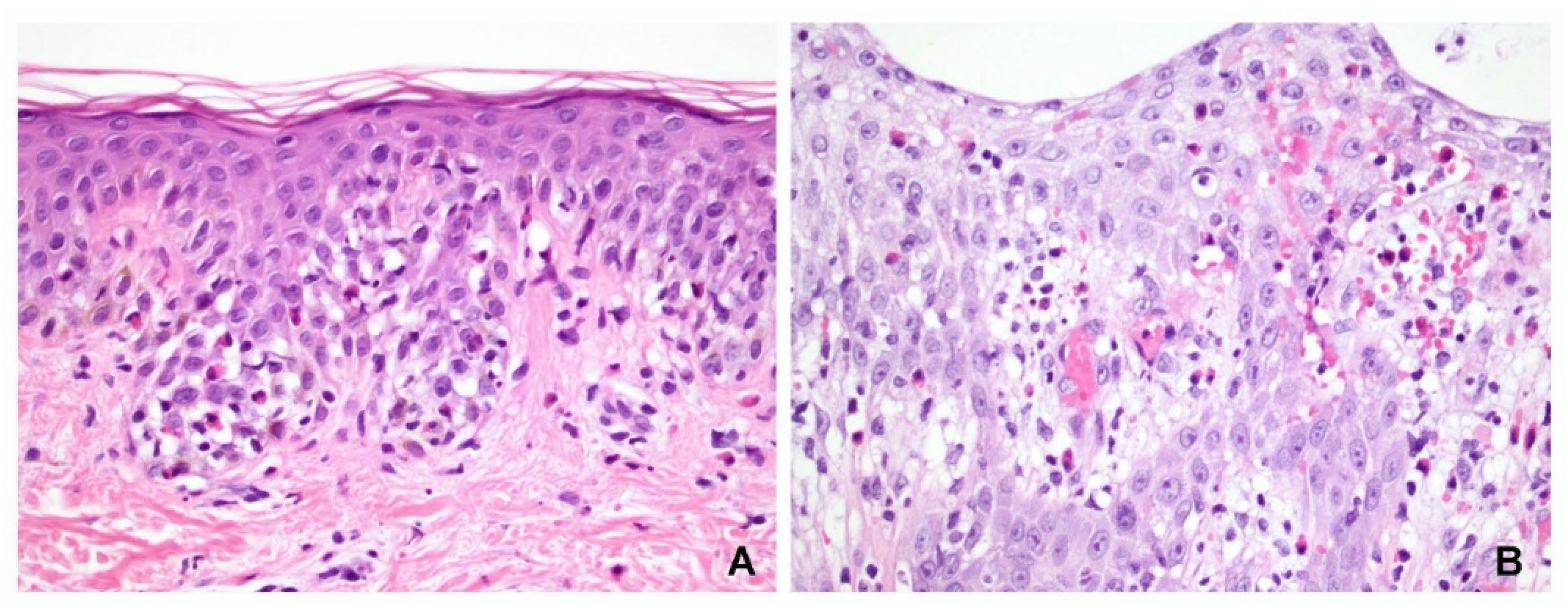 Dermatopathology 09 00022 g004 550