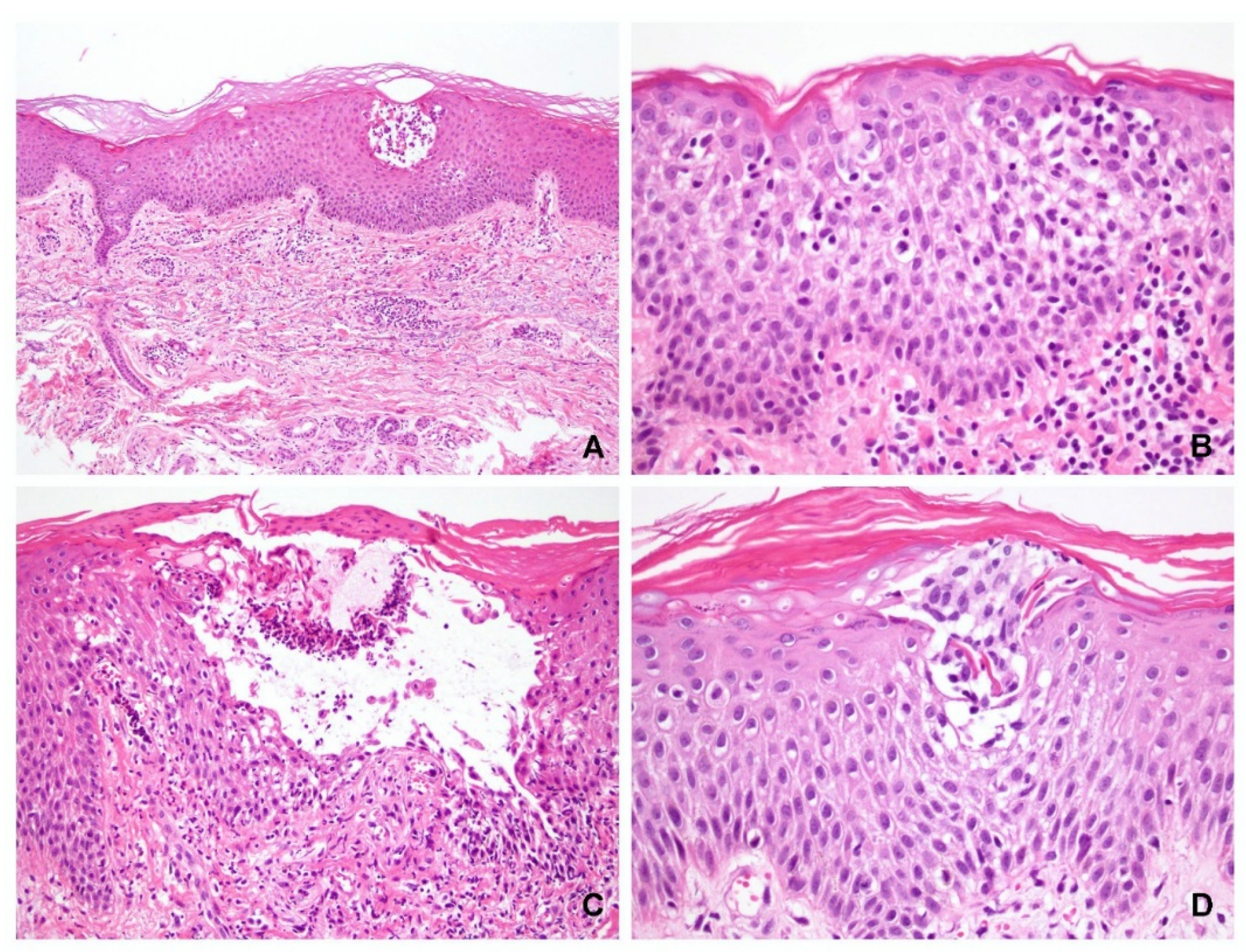 Dermatopathology 09 00022 g005 550