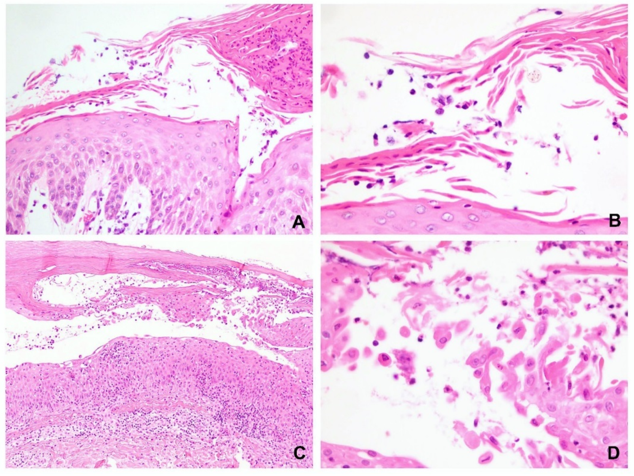 Dermatopathology 09 00022 g006 550