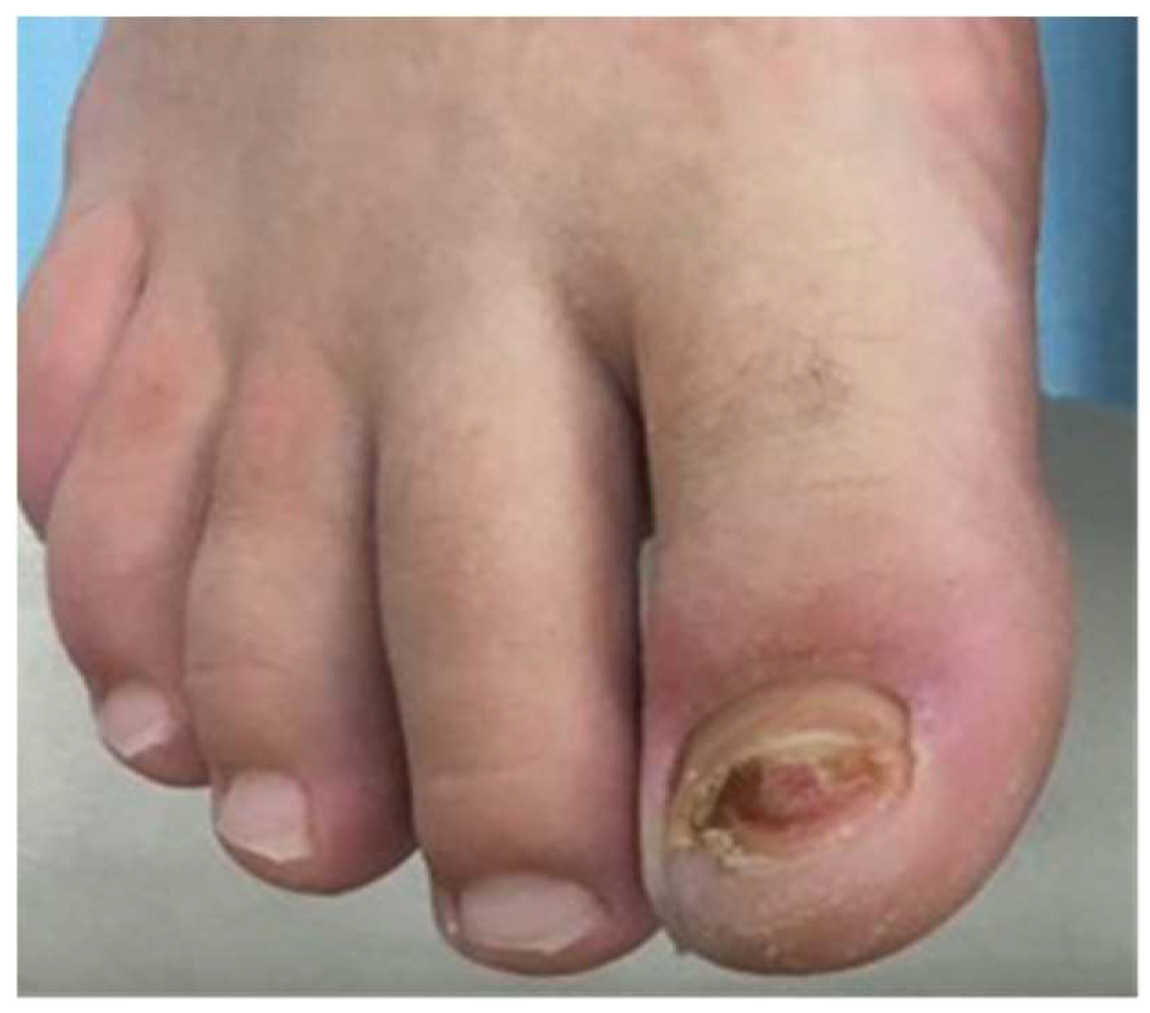 Dermatopathology 09 00024 g004 550