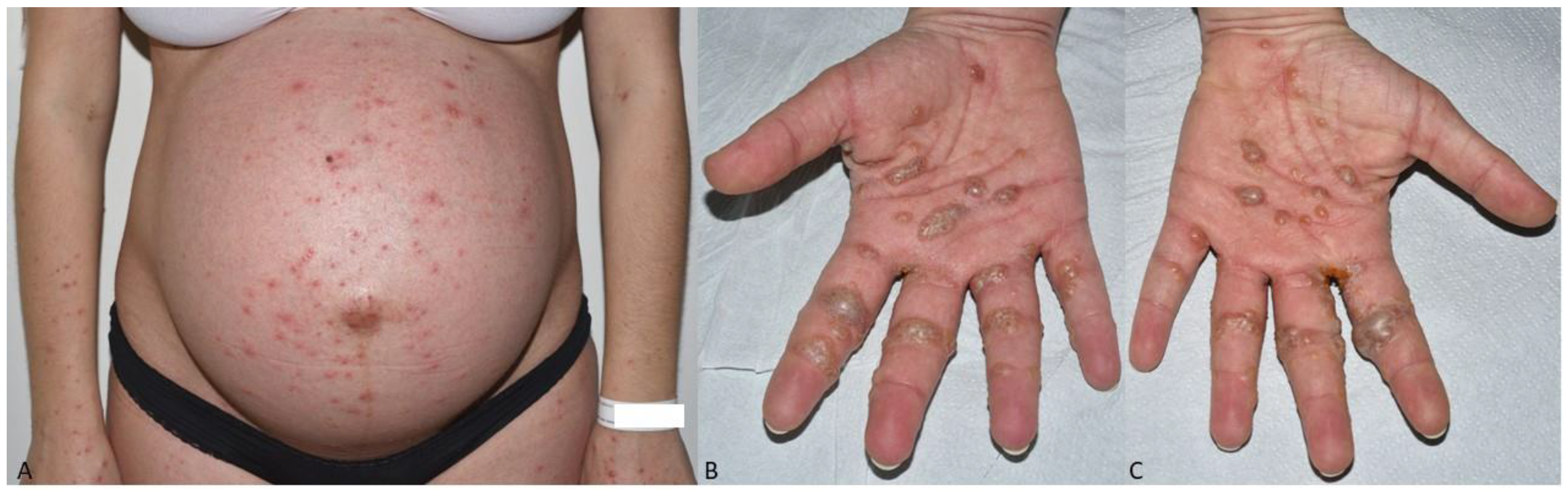 Dermatopathology 09 00025 g001