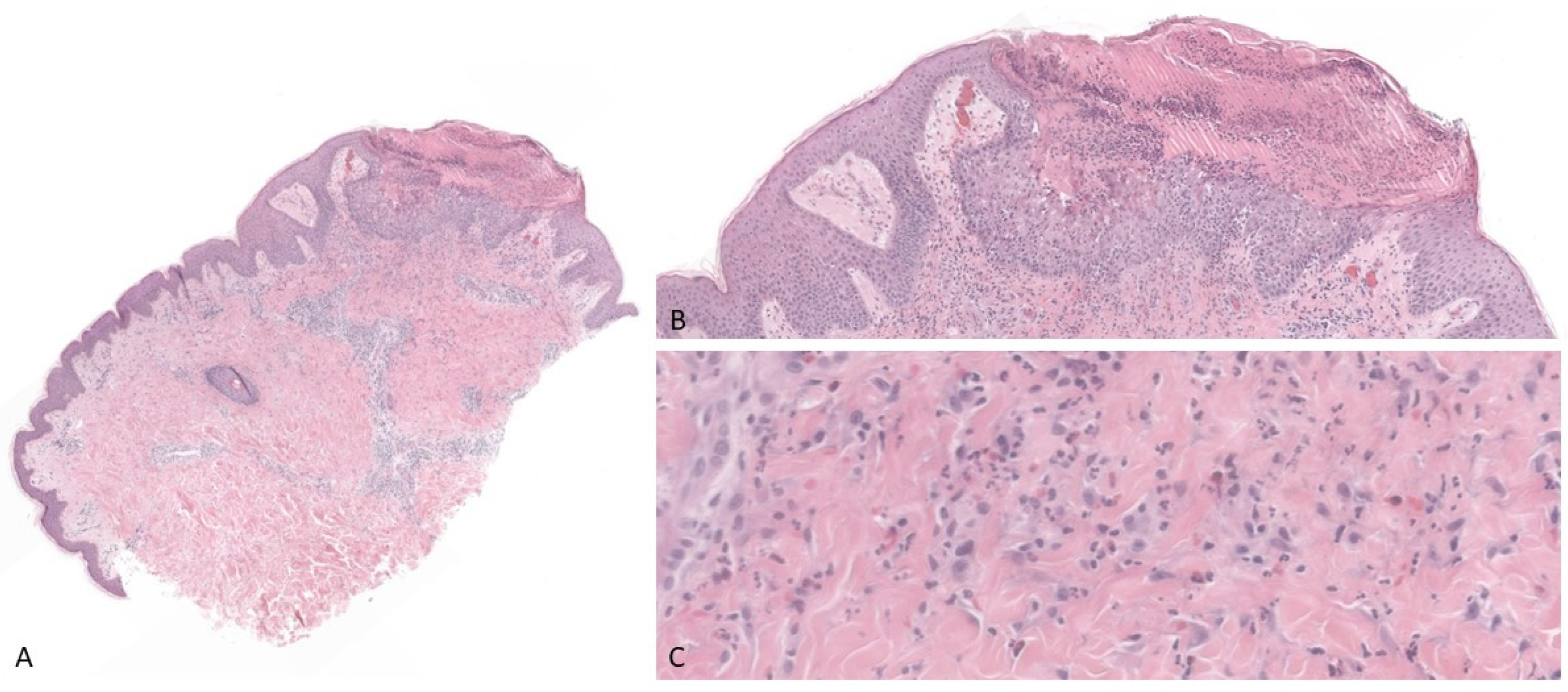 Dermatopathology 09 00025 g002