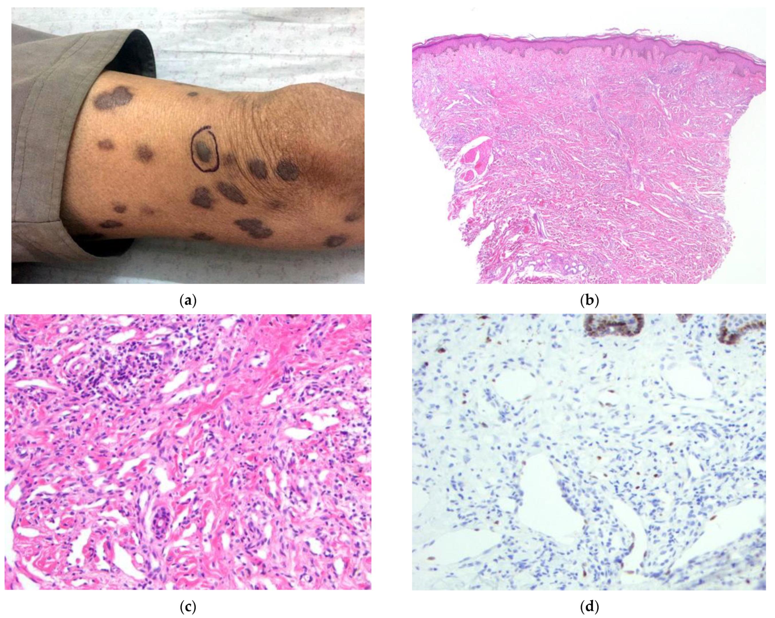 Dermatopathology 09 00030 g001