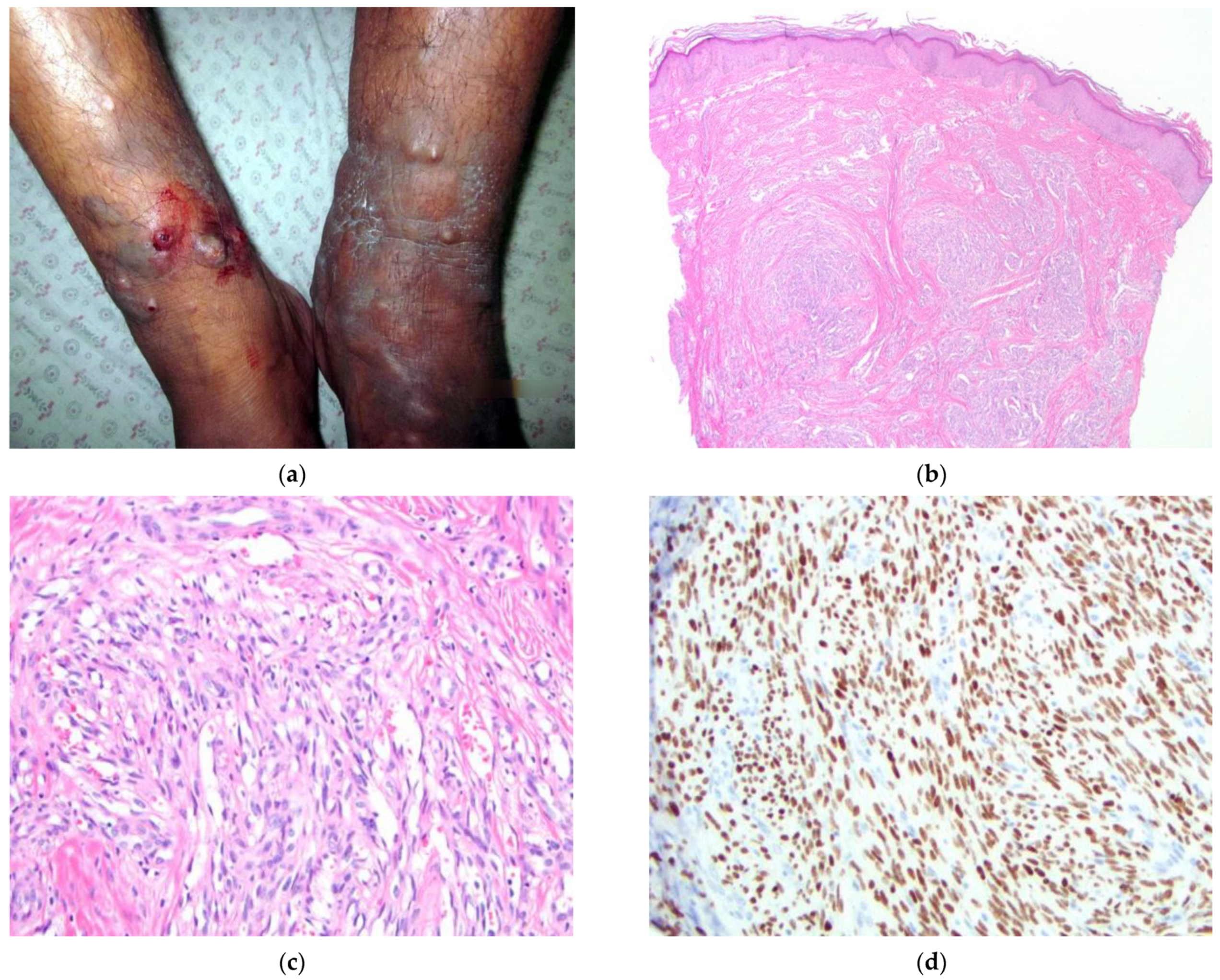Dermatopathology 09 00030 g002