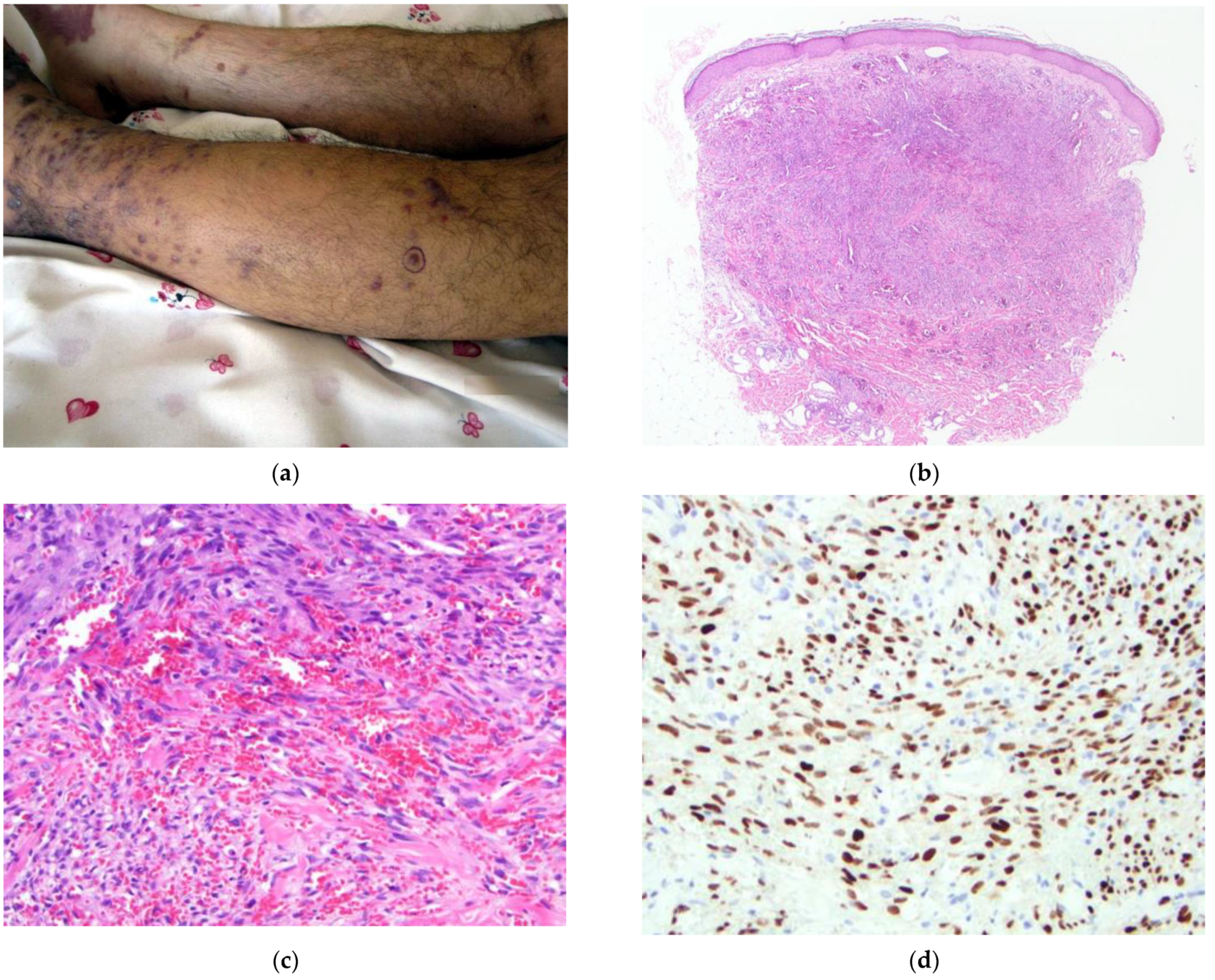 Dermatopathology 09 00030 g004