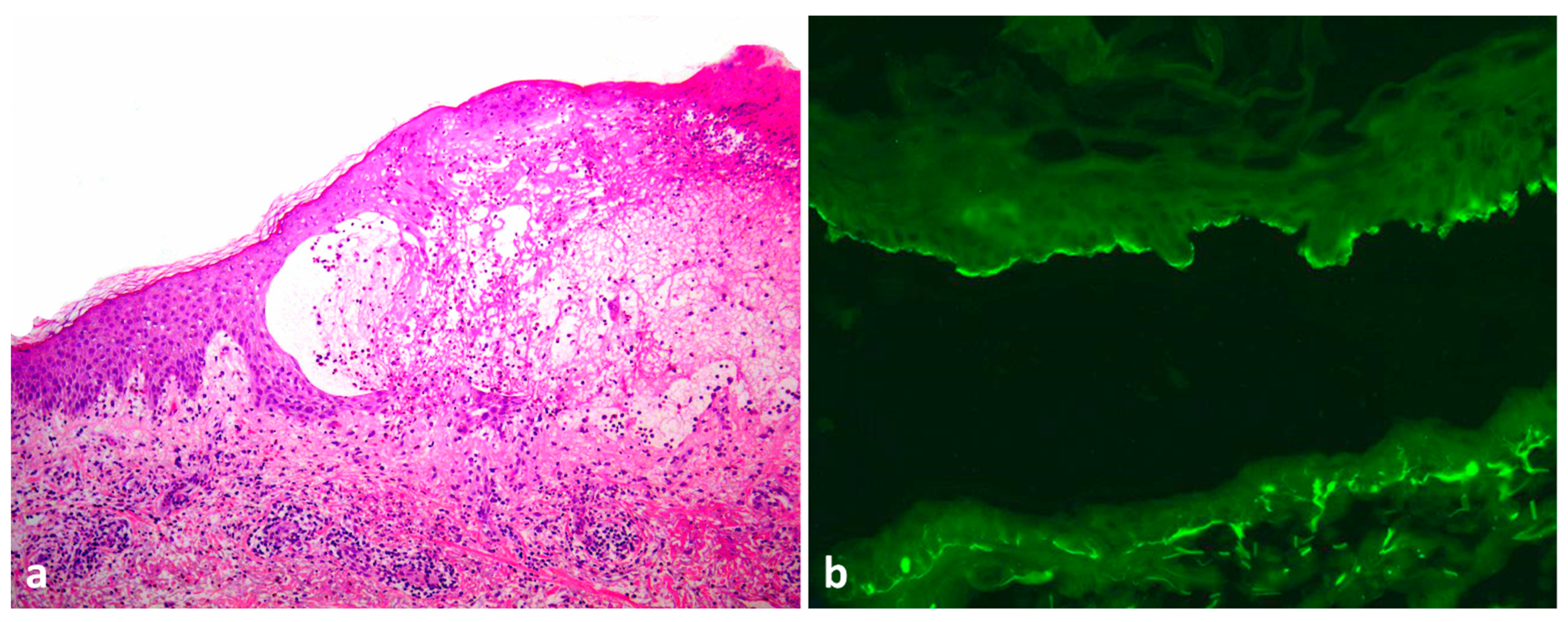 Dermatopathology 09 00033 g002 Dermatopathology 09 00033 g002