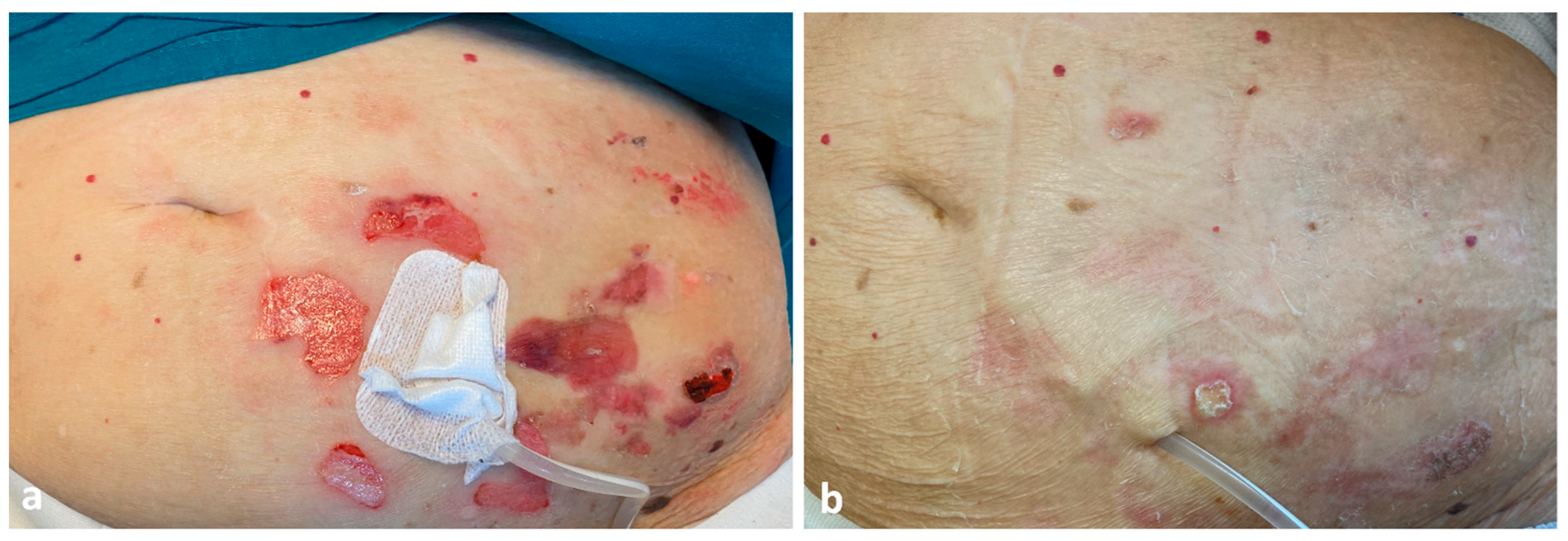 Dermatopathology 09 00033 g003 Dermatopathology 09 00033 g003