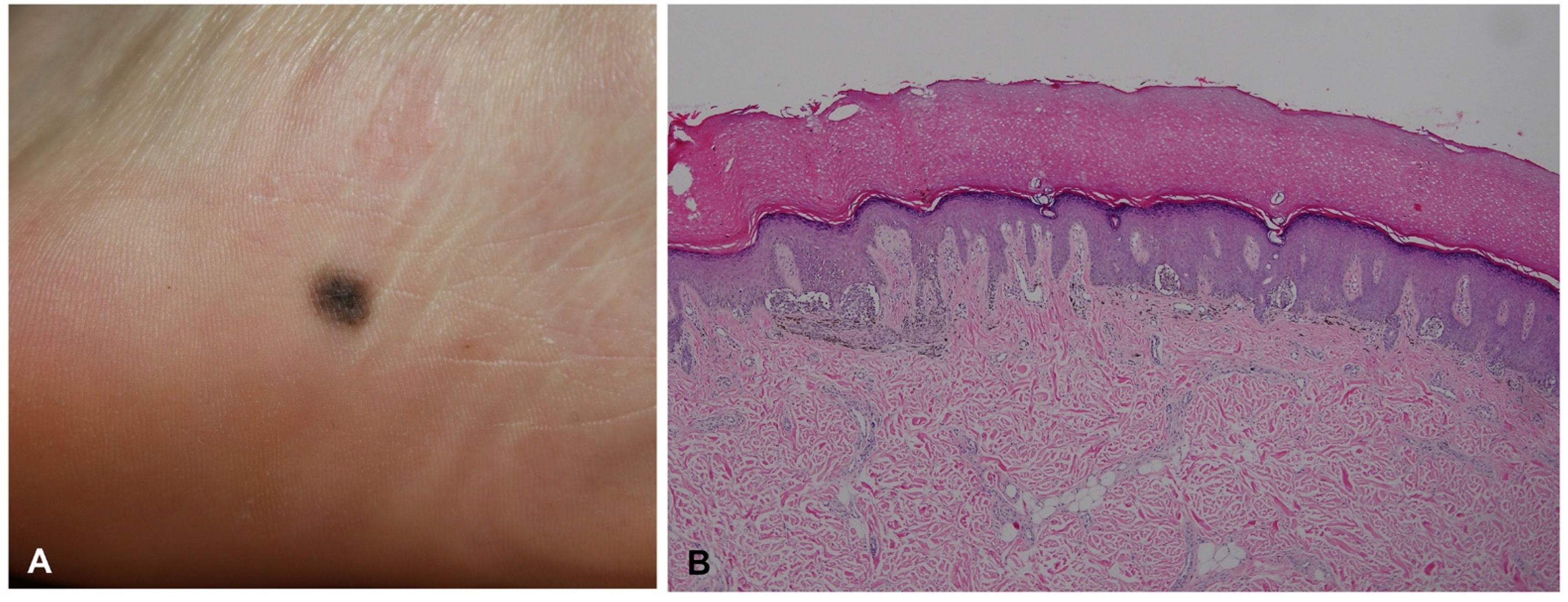 Dermatopathology 09 00035 g004