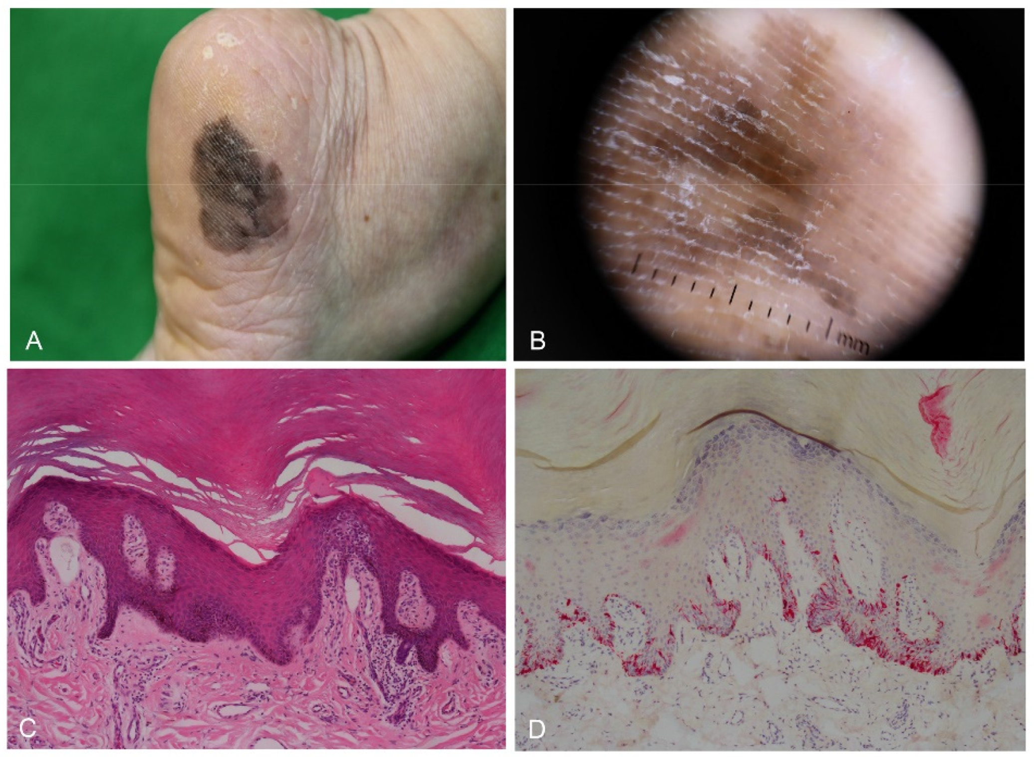 Dermatopathology 09 00035 g005