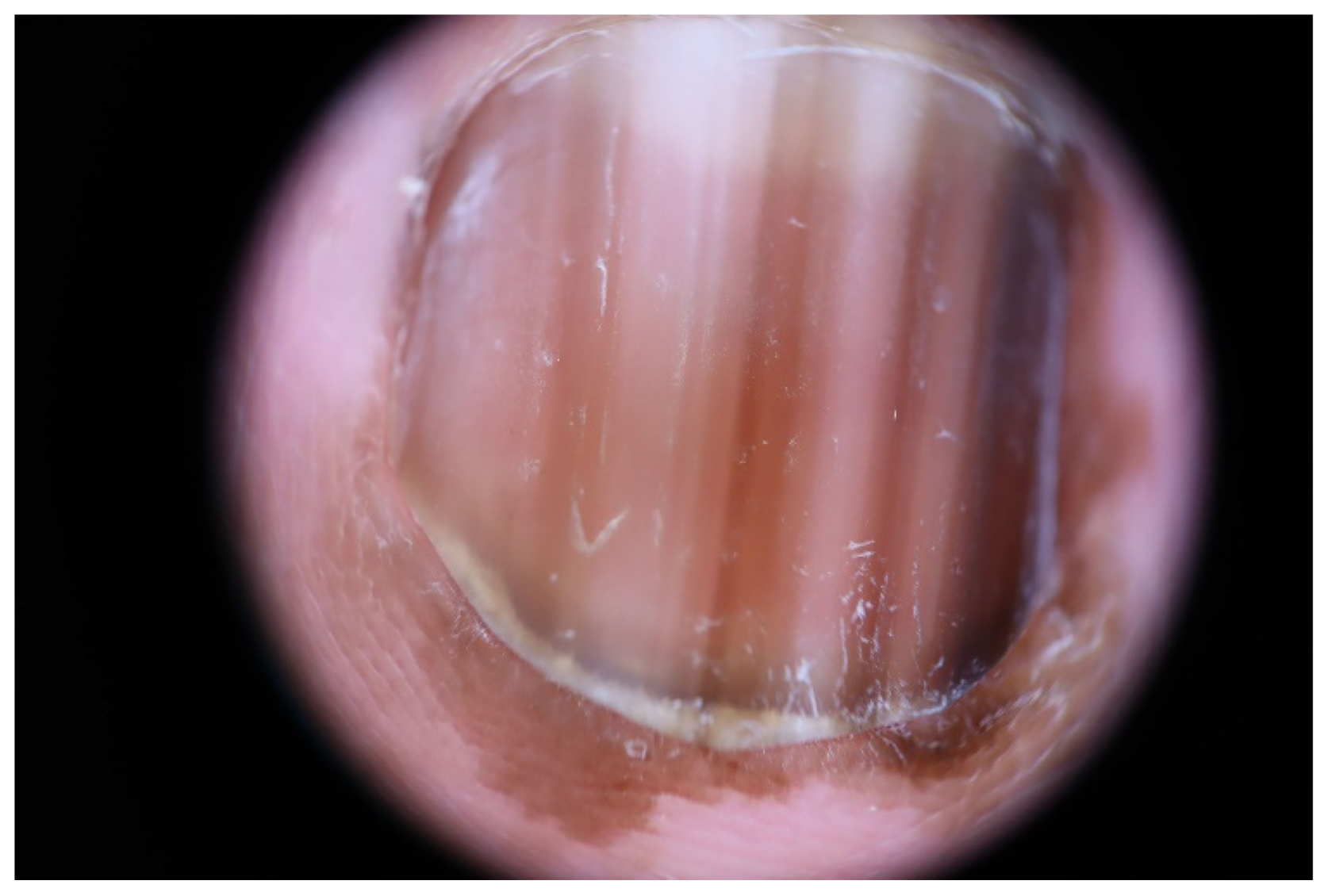 Dermatopathology 09 00035 g006