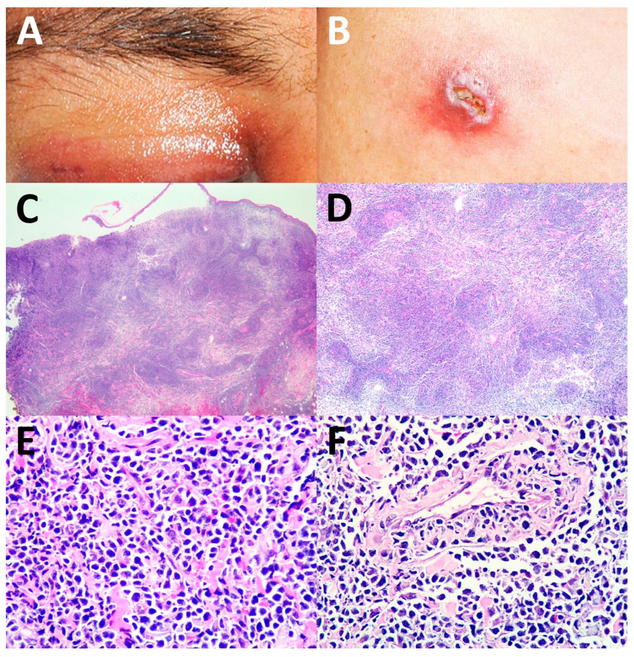 Dermatopathology 09 00037 g001