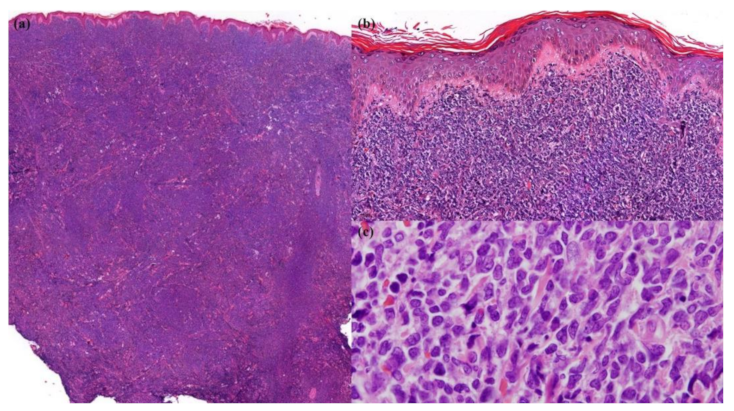 Dermatopathology 09 00038 g002
