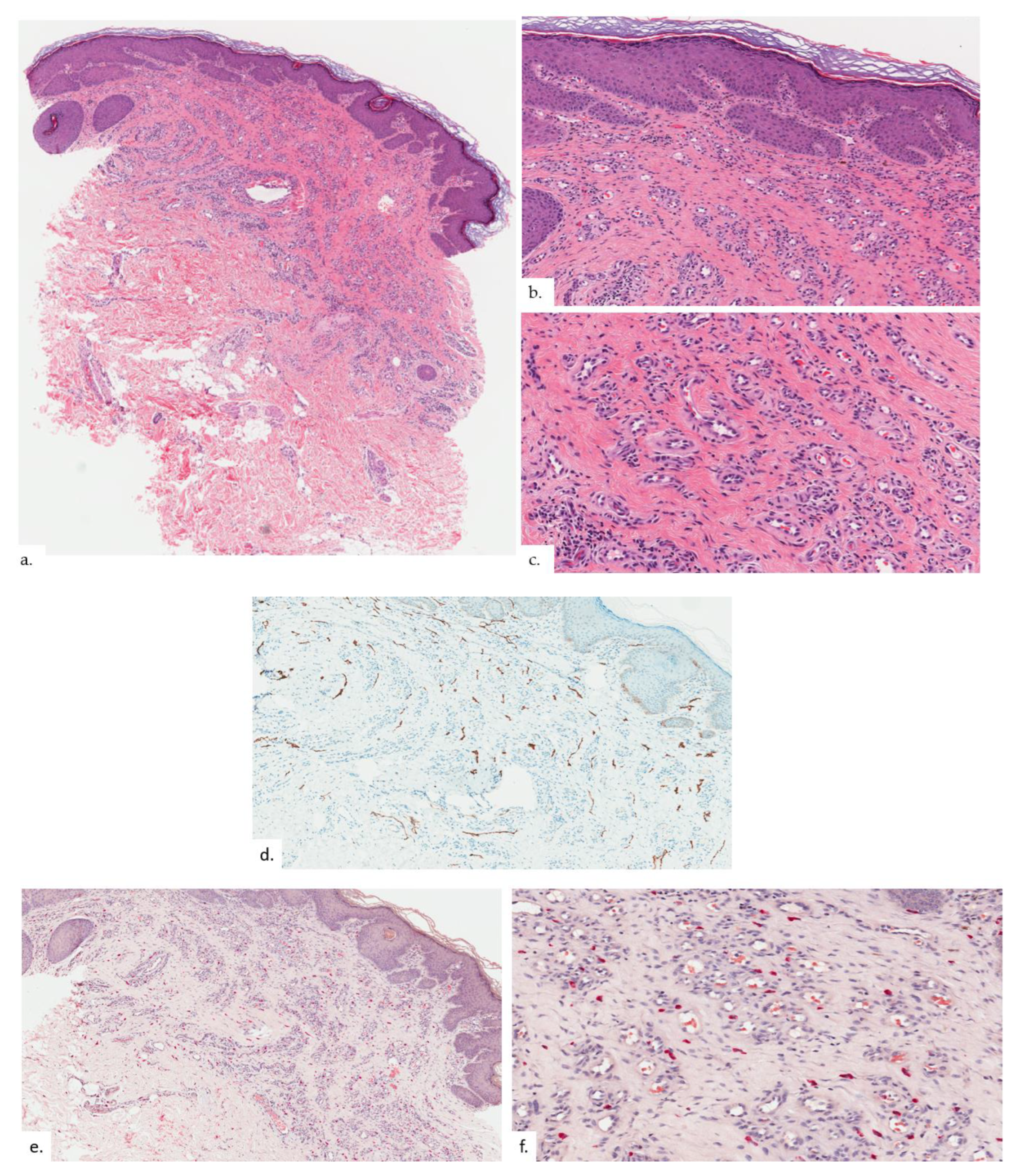Dermatopathology 09 00040 g002