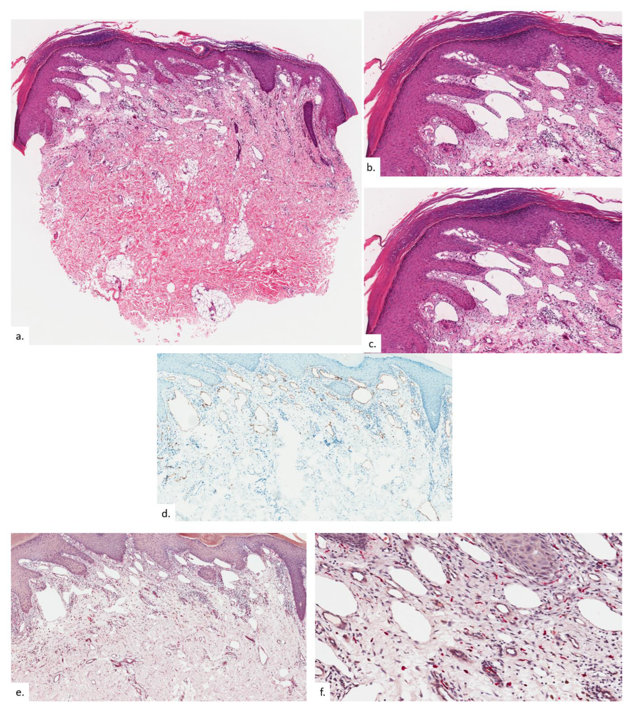 Dermatopathology 09 00040 g004