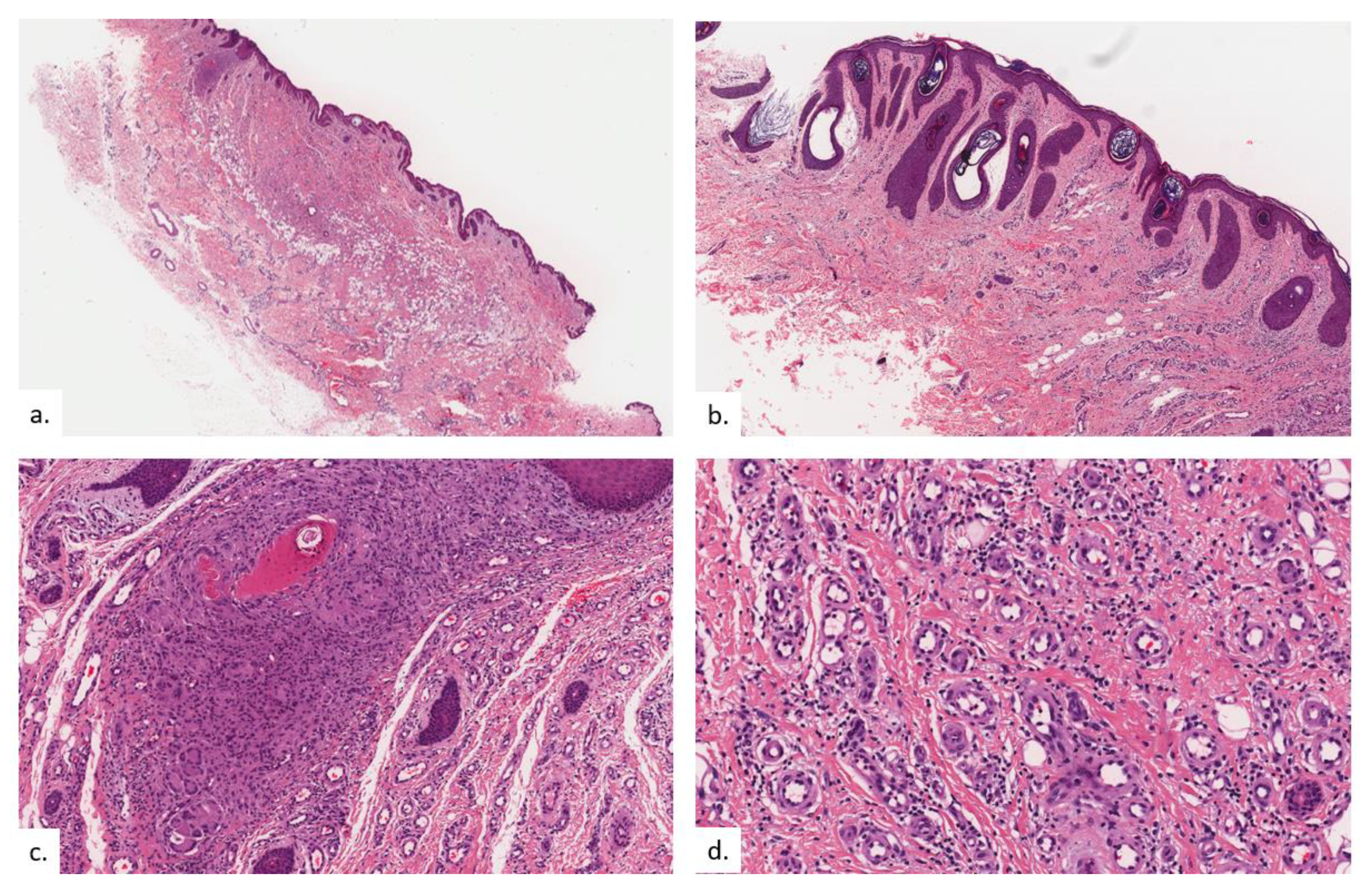 Dermatopathology 09 00040 g008a
