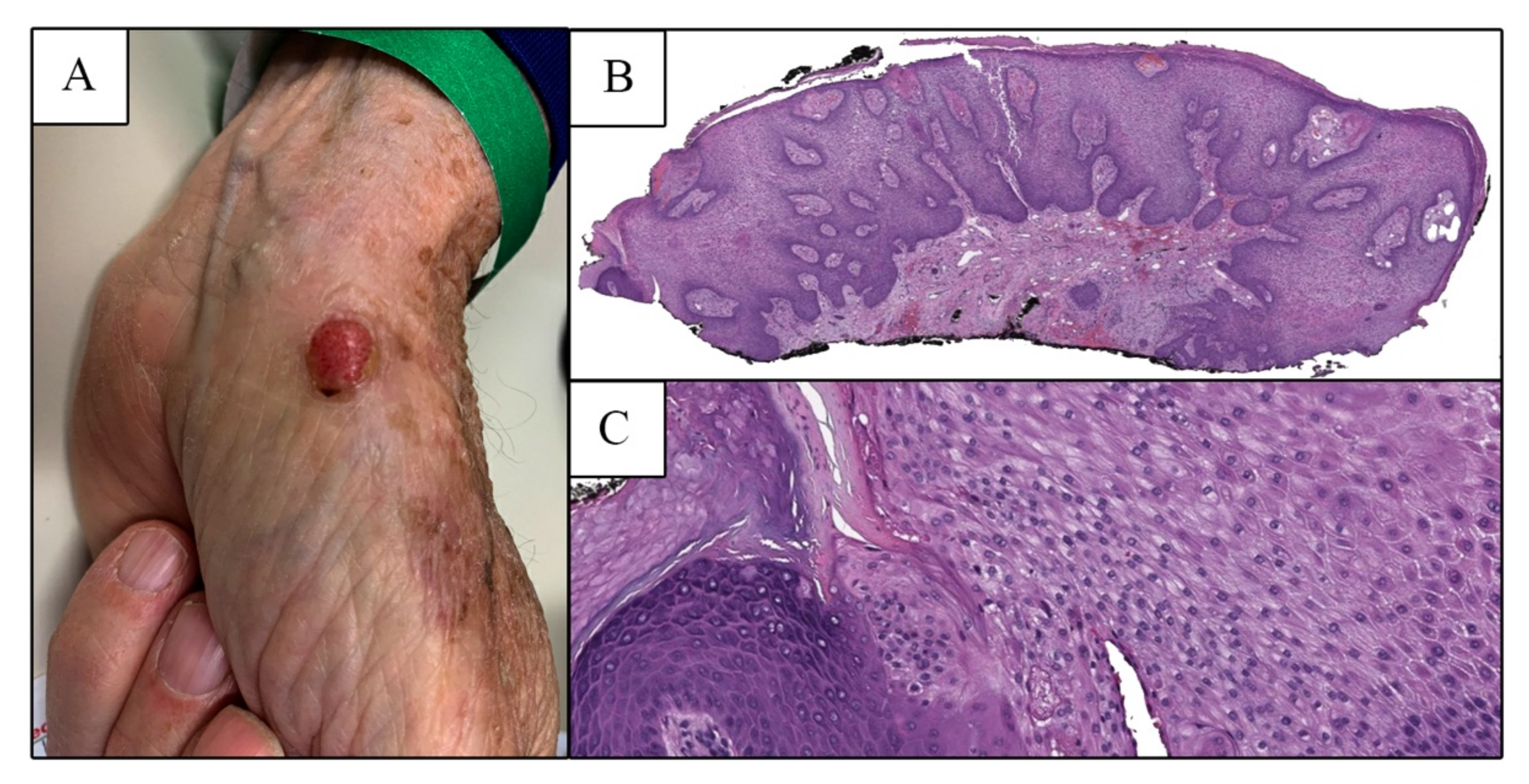 Dermatopathology 09 00041 g001 Dermatopathology 09 00041 g001