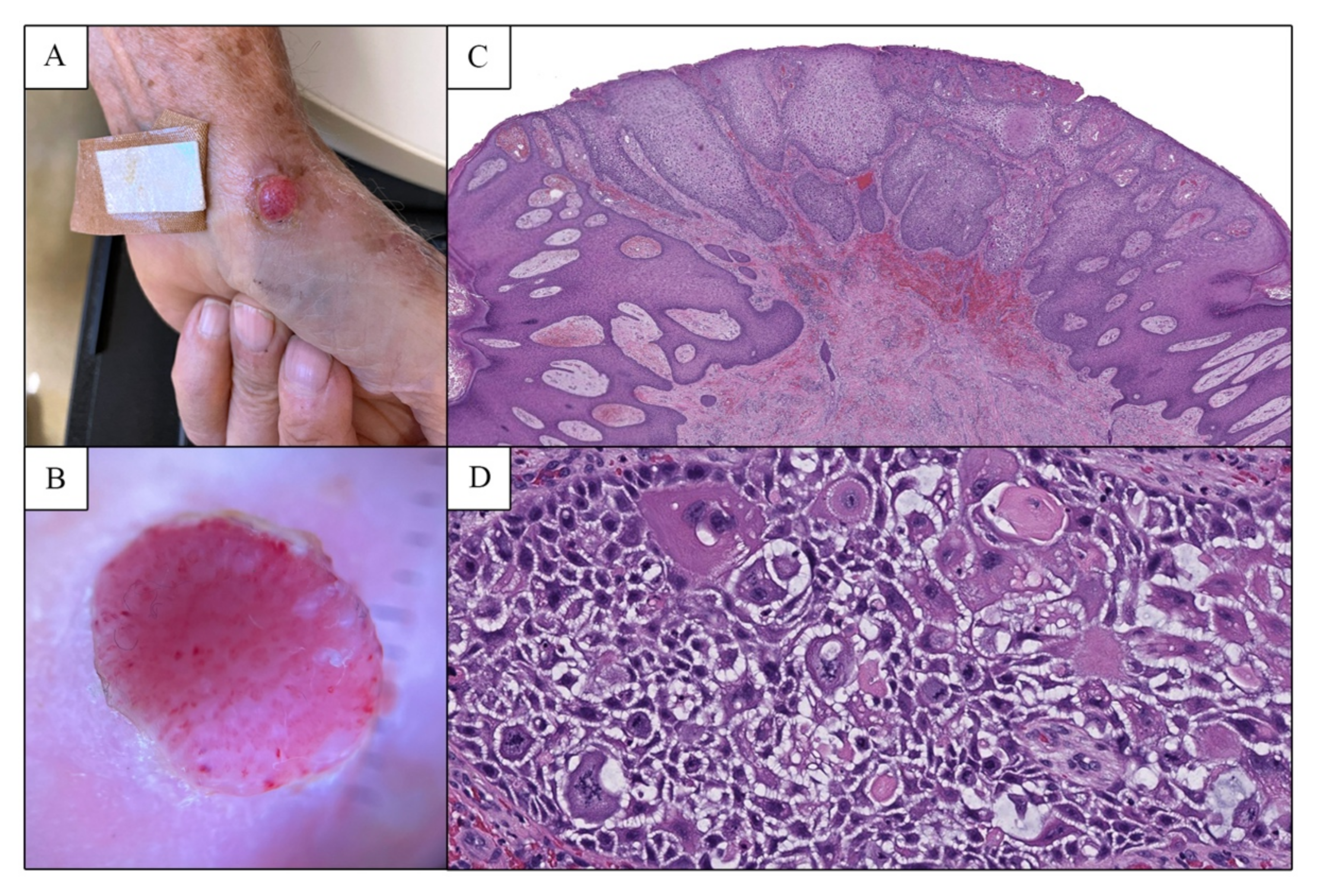 Dermatopathology 09 00041 g002 Dermatopathology 09 00041 g002